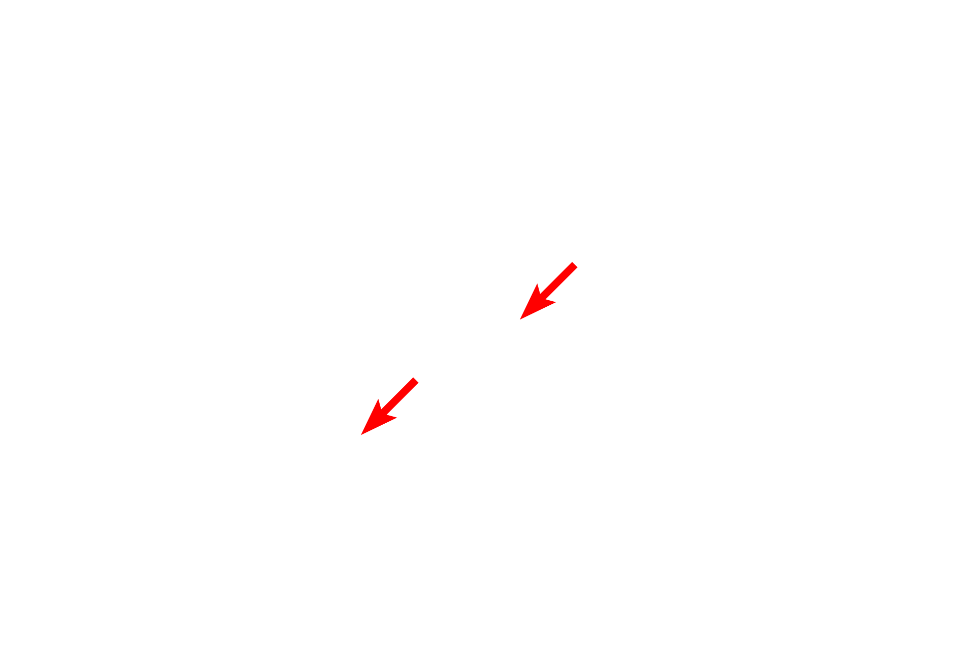  - Euchromatin <p>Most nuclei contain a mixture of heterochromatin and euchromatin.  This lymphocyte nucleus is very heterochromatic, with little euchromatin present.  7000x</p>
