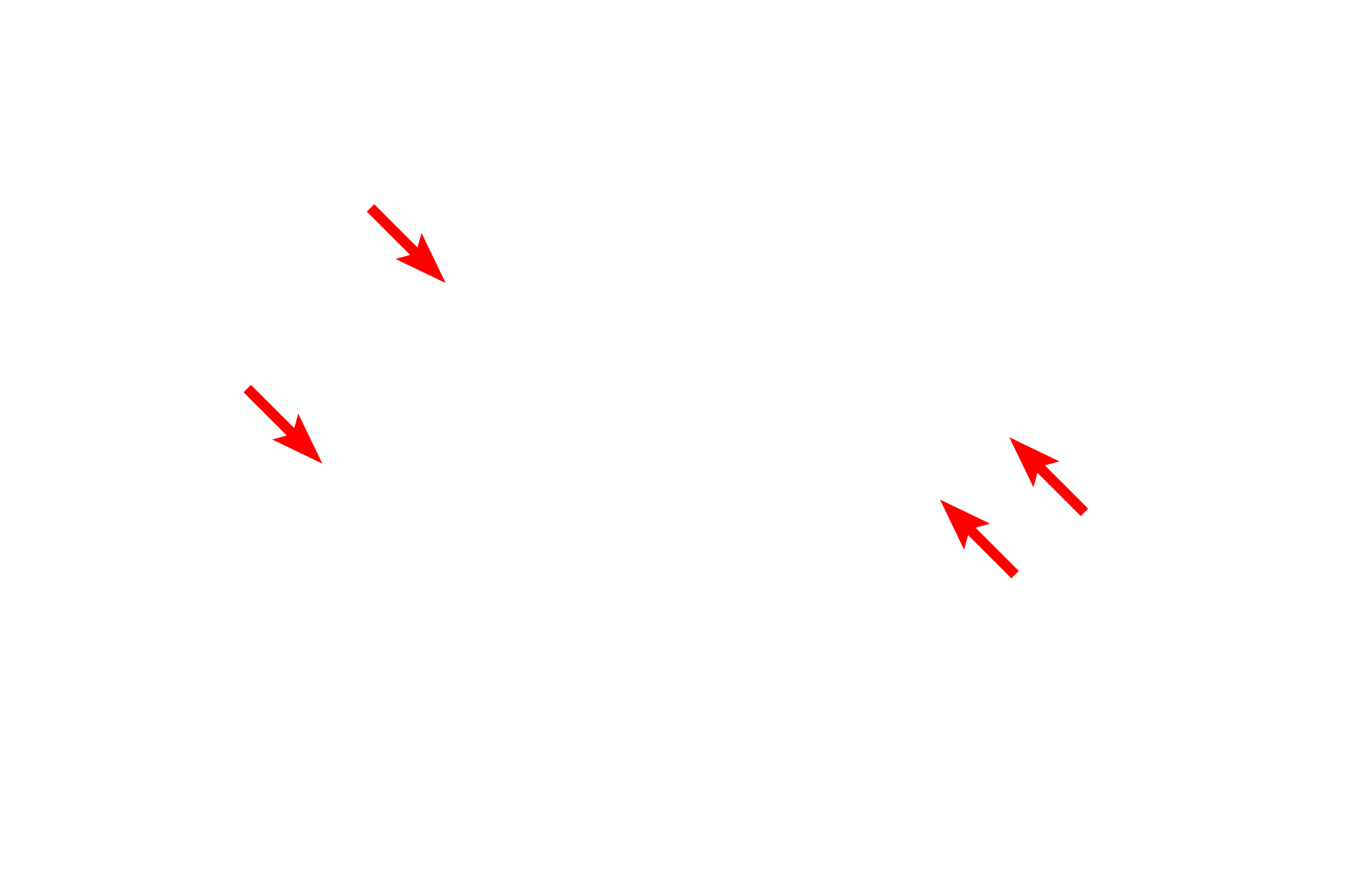  - Outer nuclear membrane <p>The nuclear envelope consists of two membranes, an inner and an outer nuclear membrane, which are separated by the perinuclear space.  The perinuclear space and outer nuclear envelope are continuous with the RER.  The nuclear envelope has periodic openings called nuclear pores.  10,000x</p>
