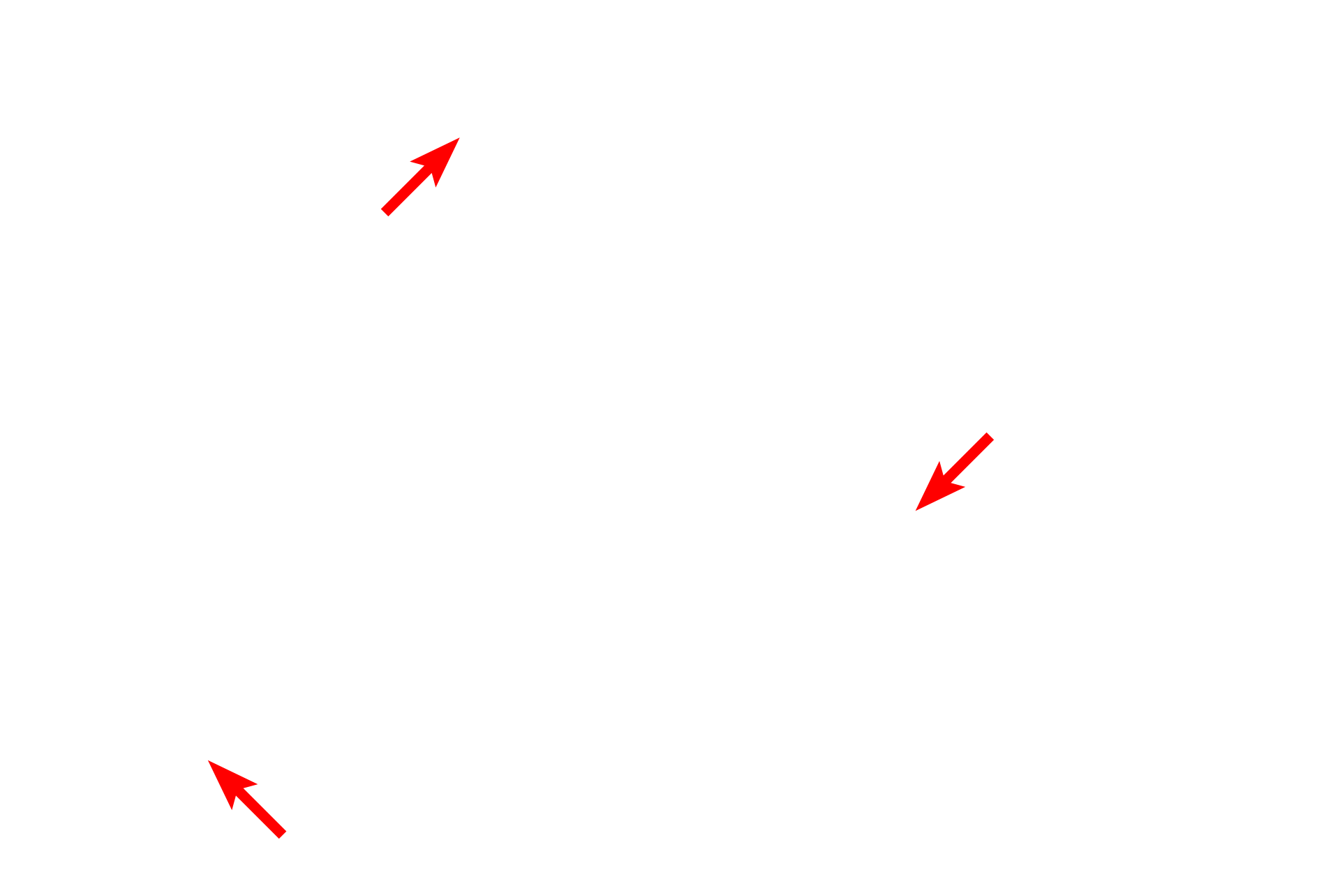  - Perinuclear space <p>The nuclear envelope consists of two membranes, an inner and an outer nuclear membrane, which are separated by the perinuclear space.  The perinuclear space and outer nuclear envelope are continuous with the RER.  The nuclear envelope has periodic openings called nuclear pores.  10,000x</p>

