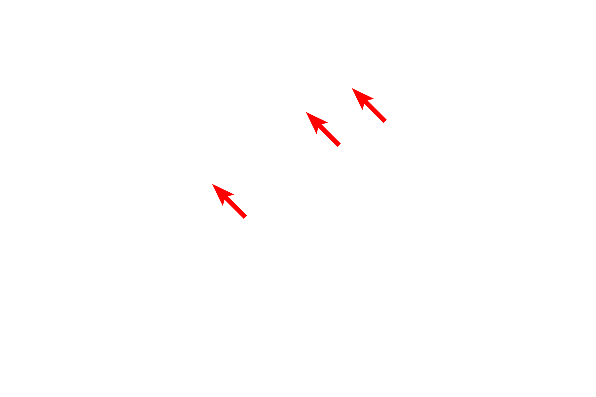  - Inner nuclear membrane <p>This image shows the inner and outer nuclear membranes and the intervening perinuclear space.  The outer membrane possesses ribosomes and is continuous with the rough endoplasmic reticulum (RER).  30,000x</p>
