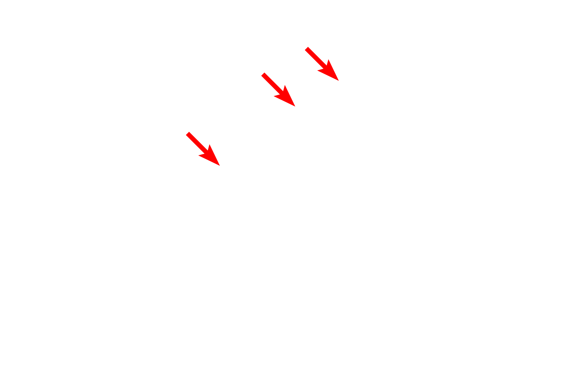  - Outer nuclear membrane <p>This image shows the inner and outer nuclear membranes and the intervening perinuclear space.  The outer membrane possesses ribosomes and is continuous with the rough endoplasmic reticulum (RER).  30,000x</p>
