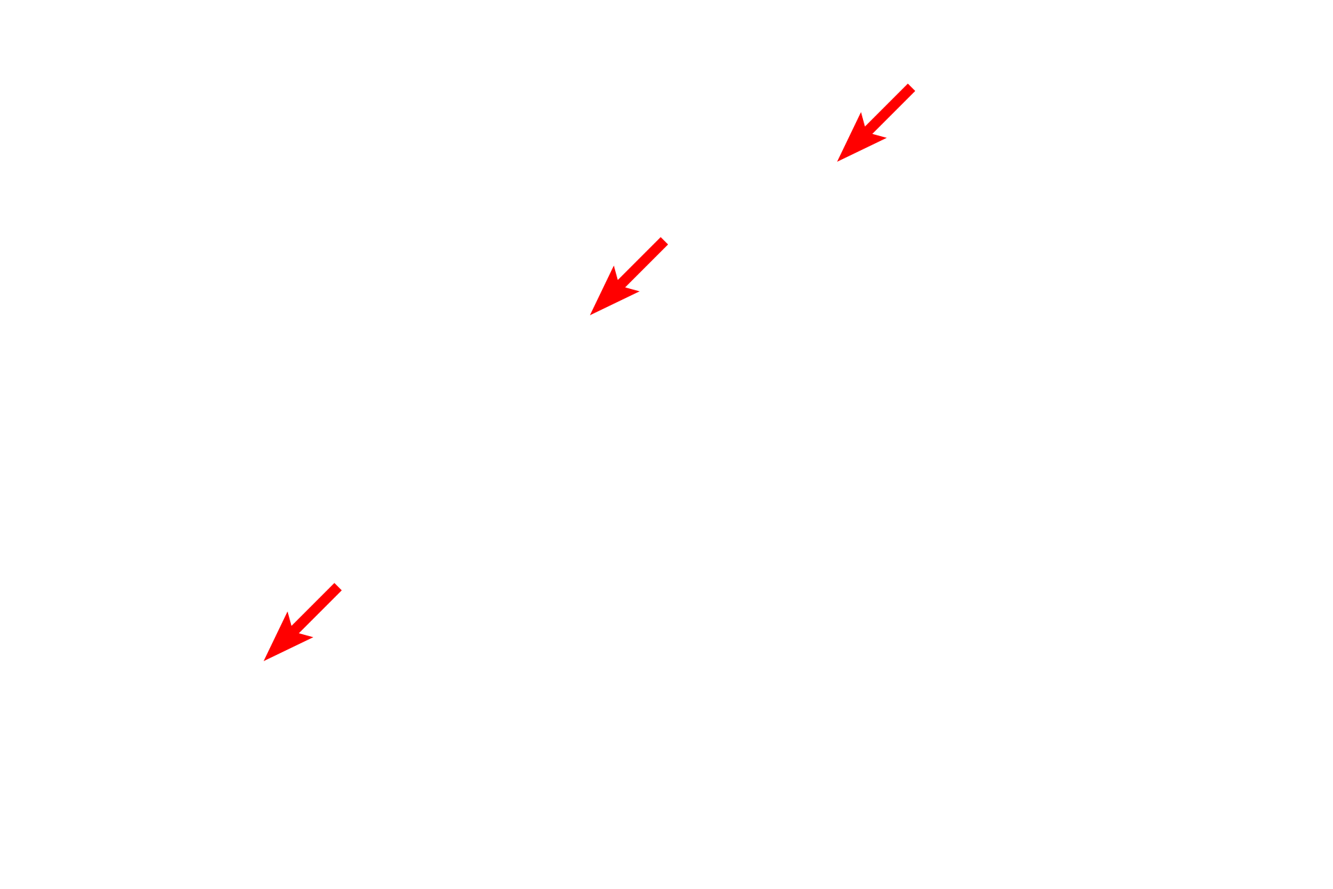  - Perinuclear space <p>This image shows the inner and outer nuclear membranes and the intervening perinuclear space.  The outer membrane possesses ribosomes and is continuous with the rough endoplasmic reticulum (RER).  30,000x</p>
