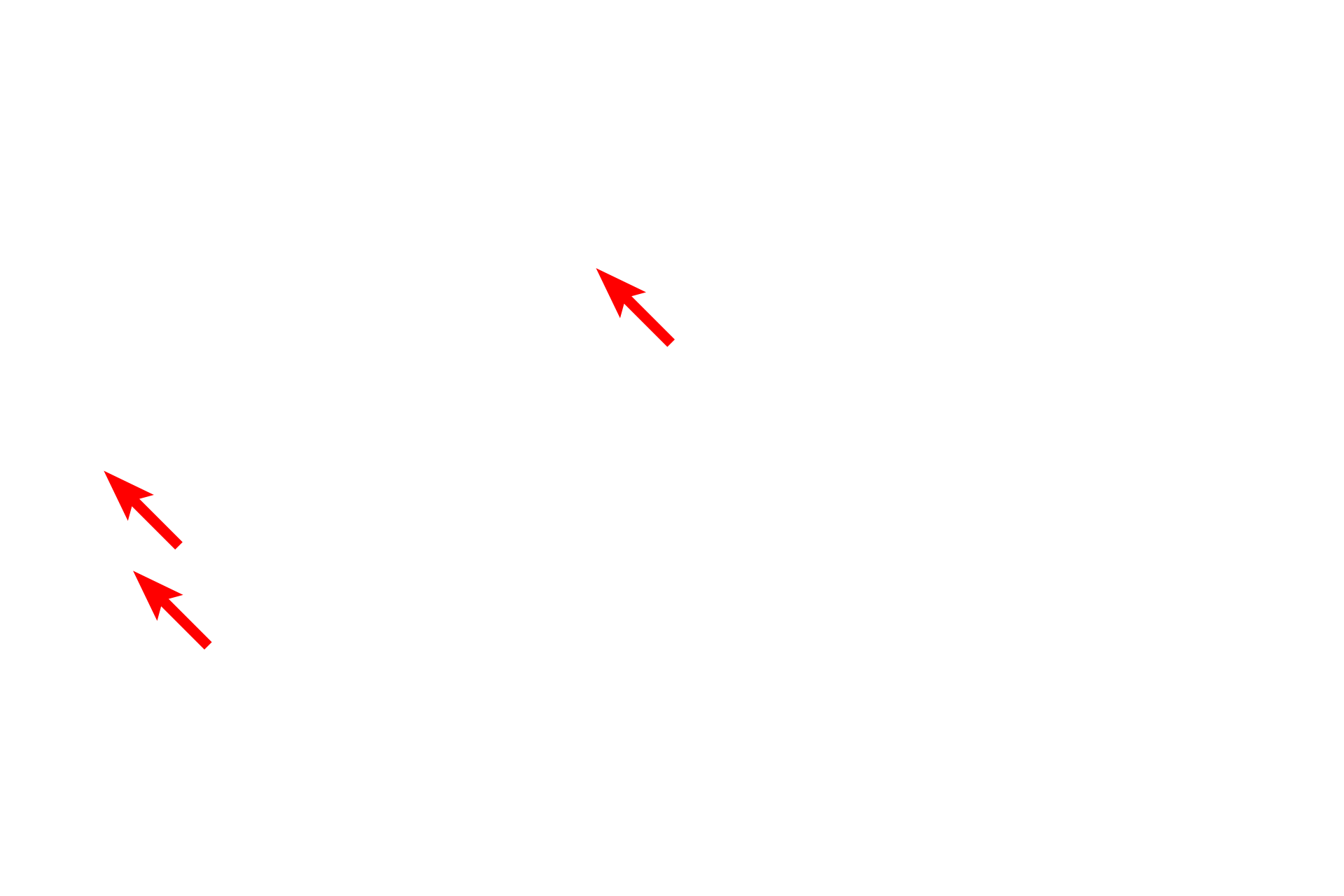 SER <p>The outer membrane possesses ribosomes and is continuous with the RER (blue arrow). Smooth endoplasmic reticulum and mitochondria are visible in the cytoplasm.</p>
