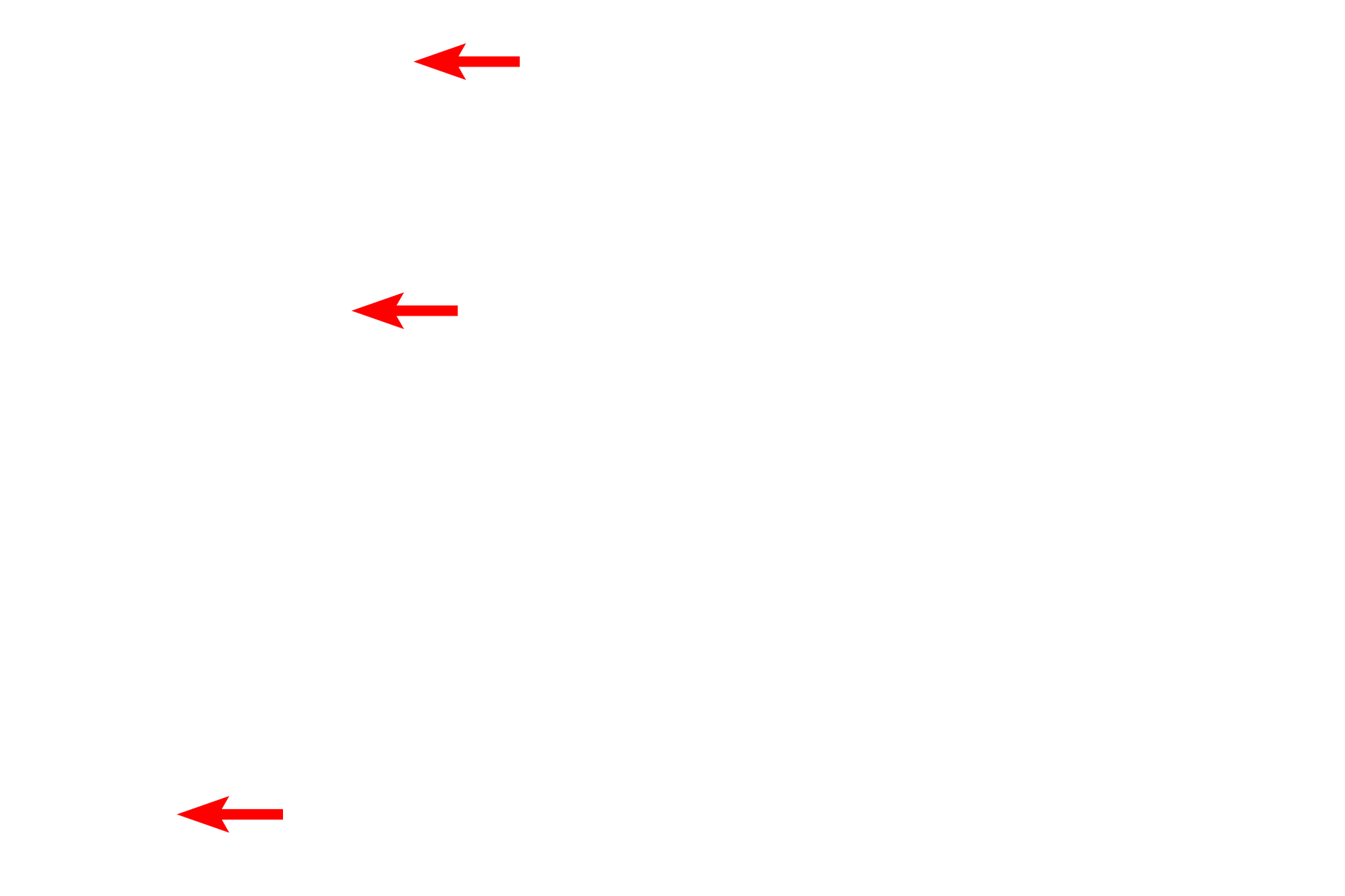 Mitochondria <p>The outer membrane possesses ribosomes and is continuous with the RER (blue arrow). Smooth endoplasmic reticulum and mitochondria are visible in the cytoplasm.</p>
