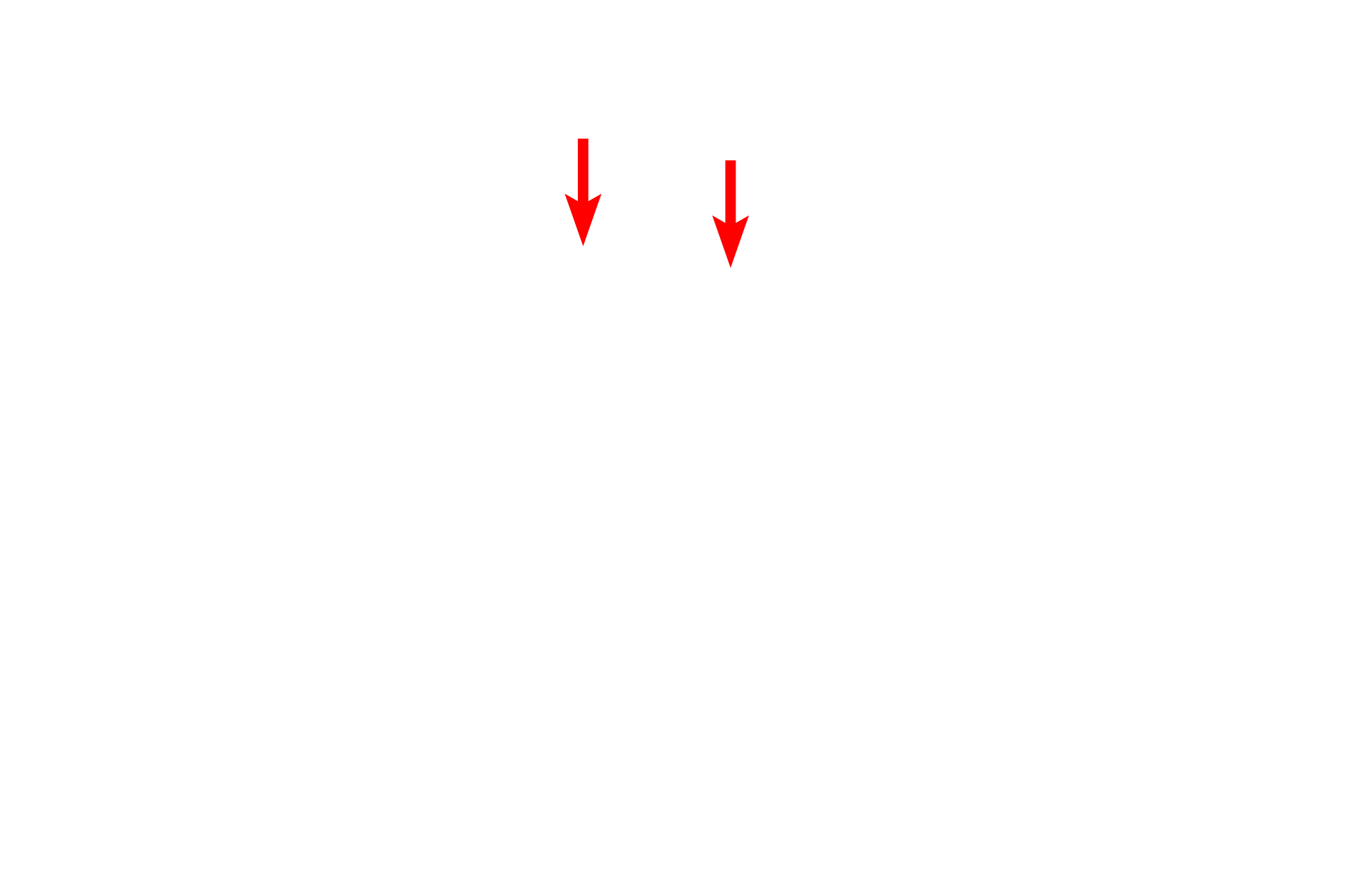  - Inner nuclear membrane <p>This freeze fracture image of a lymphocyte shows a fracture plane where separation has occurred between the outer nuclear membrane and the inner nuclear membrane, thereby revealing the perinuclear space around the nucleus.  Organelles, e.g., mitochondria and vesicles, are also visible in the cytoplasm.  12,000x</p>
