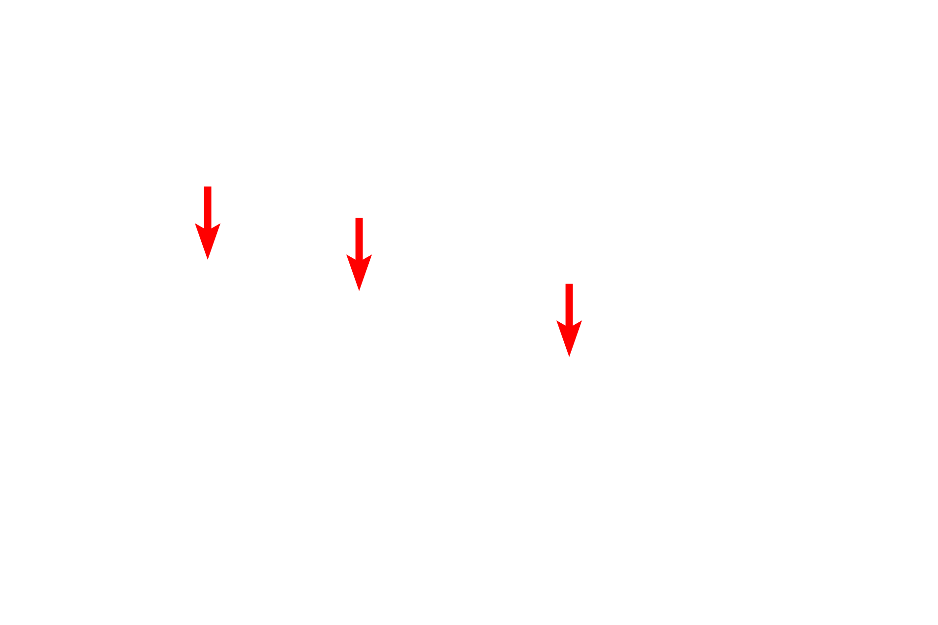 Outer nuclear membrane <p>The nuclear envelope contains openings called nuclear pores, which consist of a complex of proteins encircling an opening.  Nuclear pores regulate the bi-directional transit of materials between the cytoplasm and nucleus.  In this image, six pores are visible and are marked by sites where the perinuclear space is obscured and the heterochromatin is interrupted.  38,000x</p>
