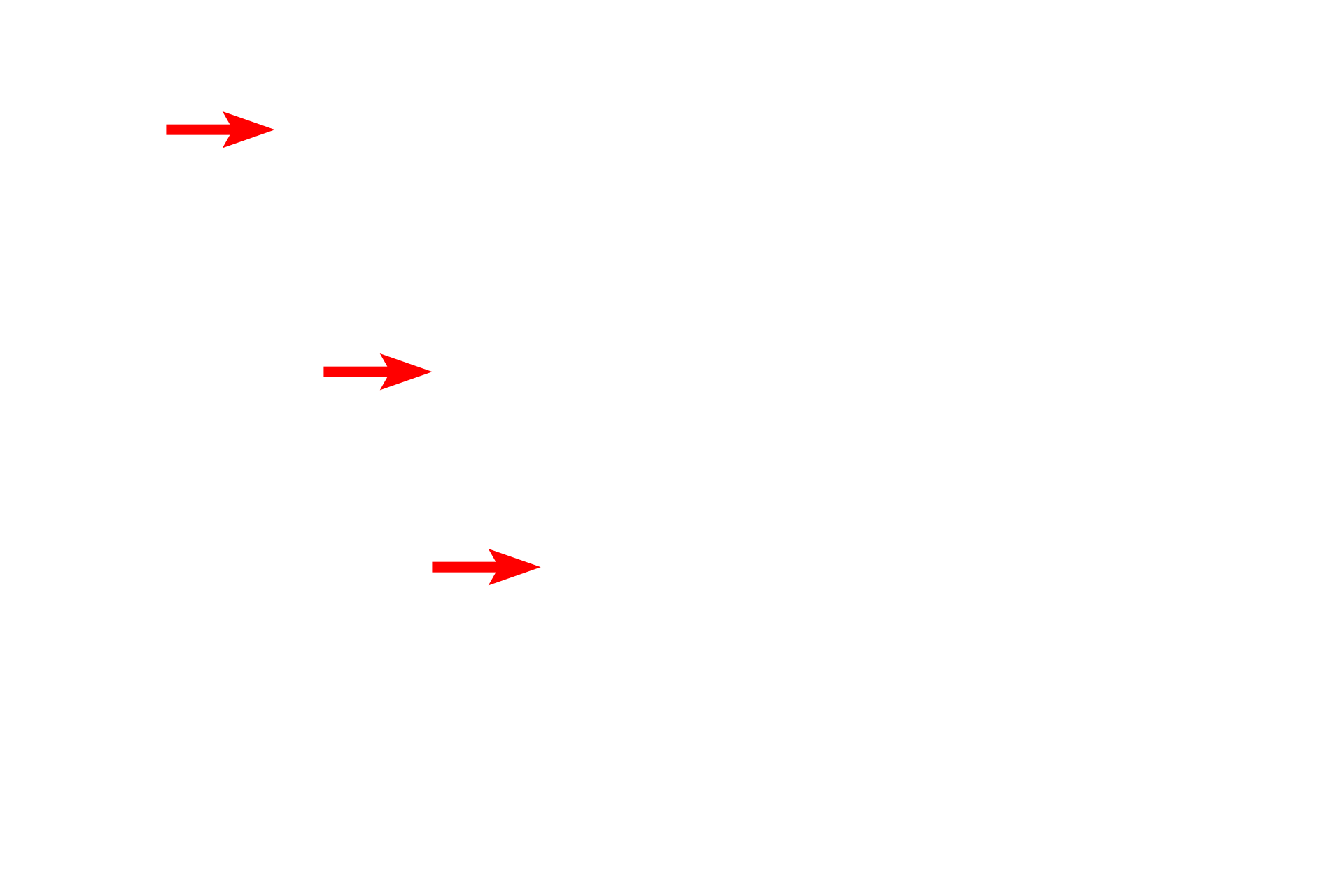  - Nuclear pores <p>A high magnification electron micrograph demonstrates nuclear pores.  Pores are normally located at points of interruption of perinuclear heterochromatin.  The illusion of a diaphragm spanning each pore results from the presence of proteins forming a pore complex.  50,000x</p>
