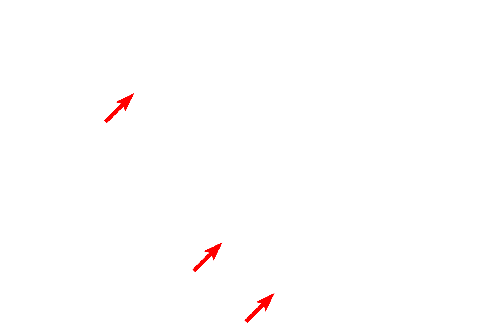  - Nuclear envelope <p>A high magnification electron micrograph demonstrates nuclear pores.  Pores are normally located at points of interruption of perinuclear heterochromatin.  The illusion of a diaphragm spanning each pore results from the presence of proteins forming a pore complex.  50,000x</p>
