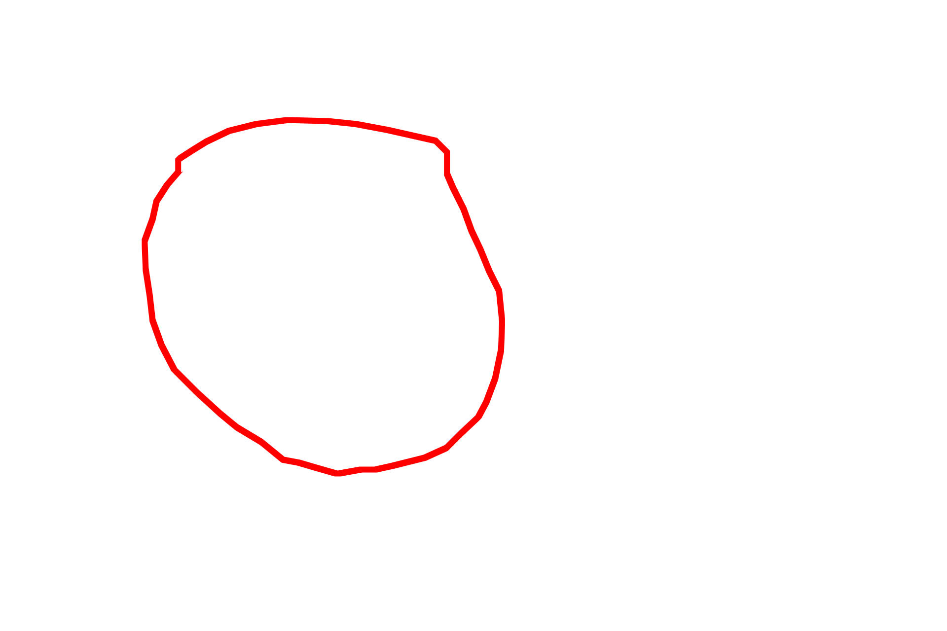 Nucleolus <p>This EM shows the subdivisions of the nucleolus.  The palest region, the fibrillar center, contains the nucleolar organizing regions of multiple chromosomes; the pars fibrosa (dense fibrillar component) contains the newly transcribed rRNA; and the pars granulosa contains maturing ribosomes.  This nucleolus is partially surrounded by perinucleolar heterochromatin.  35,000x</p>
