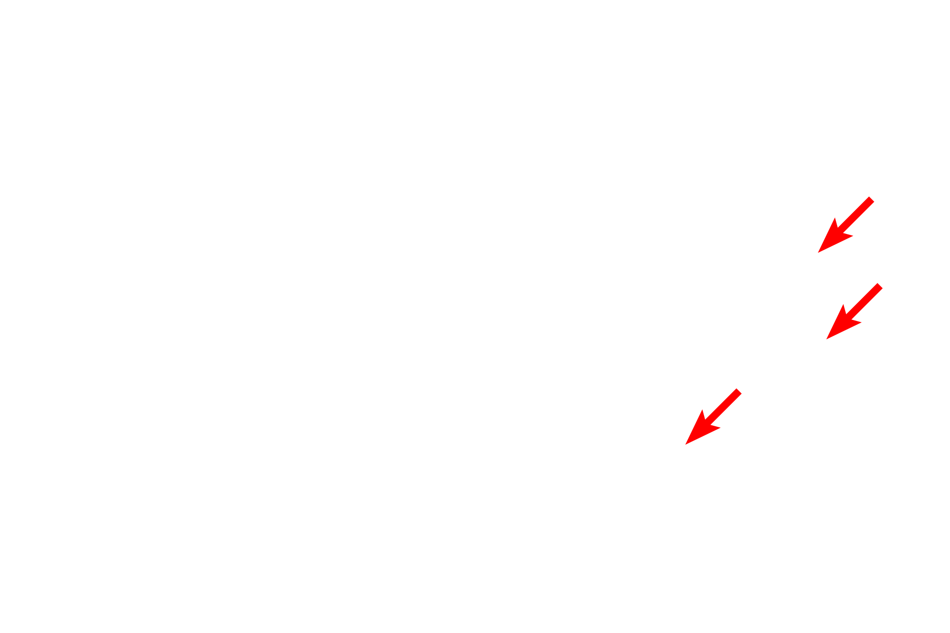 Polysomes <p>Three regions of the nucleolus are visible in this electron micrograph.  The pale areas are the nucleolar organizing centers.  The most dense areas are the pars fibrosa, which contain newly synthesized primary transcripts of RNA genes.  The pars granulosa has a granular appearance and contains maturing ribosomal particles.  30,000x</p>
