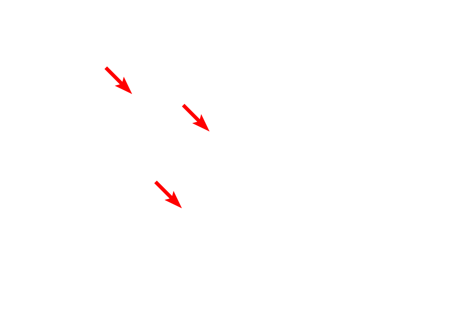  - Nucleolar organizing centers <p>Three regions of the nucleolus are visible in this electron micrograph.  The pale areas are the nucleolar organizing centers.  The most dense areas are the pars fibrosa, which contain newly synthesized primary transcripts of RNA genes.  The pars granulosa has a granular appearance and contains maturing ribosomal particles.  33,000x</p>
