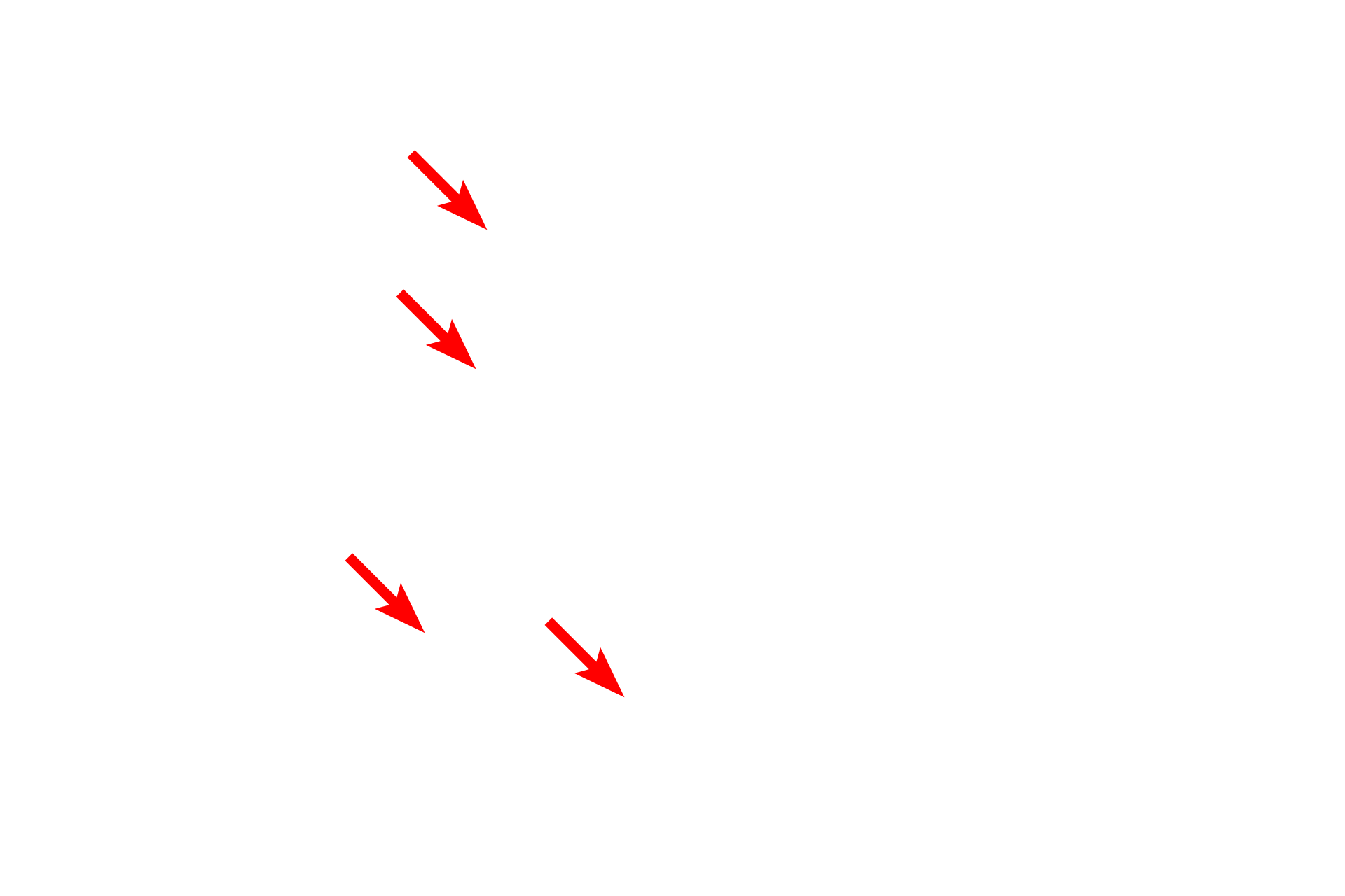 - Pars granulosa <p>Three regions of the nucleolus are visible in this electron micrograph.  The pale areas are the nucleolar organizing centers.  The most dense areas are the pars fibrosa, which contain newly synthesized primary transcripts of RNA genes.  The pars granulosa has a granular appearance and contains maturing ribosomal particles.  33,000x</p>
