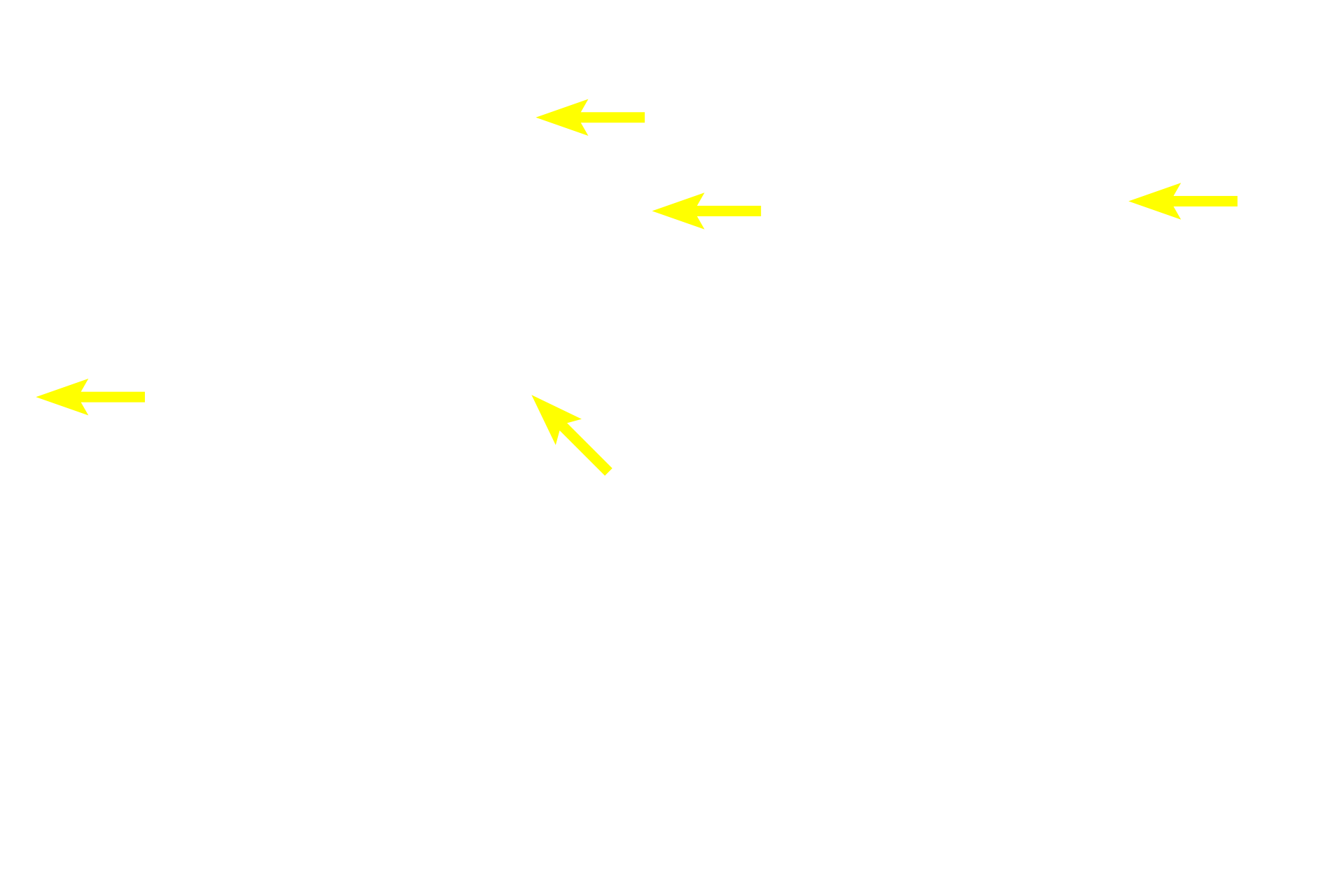 Cytoplasm <p>This image shows a variety of cell types in a connective tissue.  The nucleus is the most prominent structure in the cell and shows basophilic staining due to the presence of DNA.  Features such as nuclear shape, position and staining properties vary between cell types and are often used for cell identification.  In some cases, the cytoplasm of a cell is not visible.  1000x</p>
