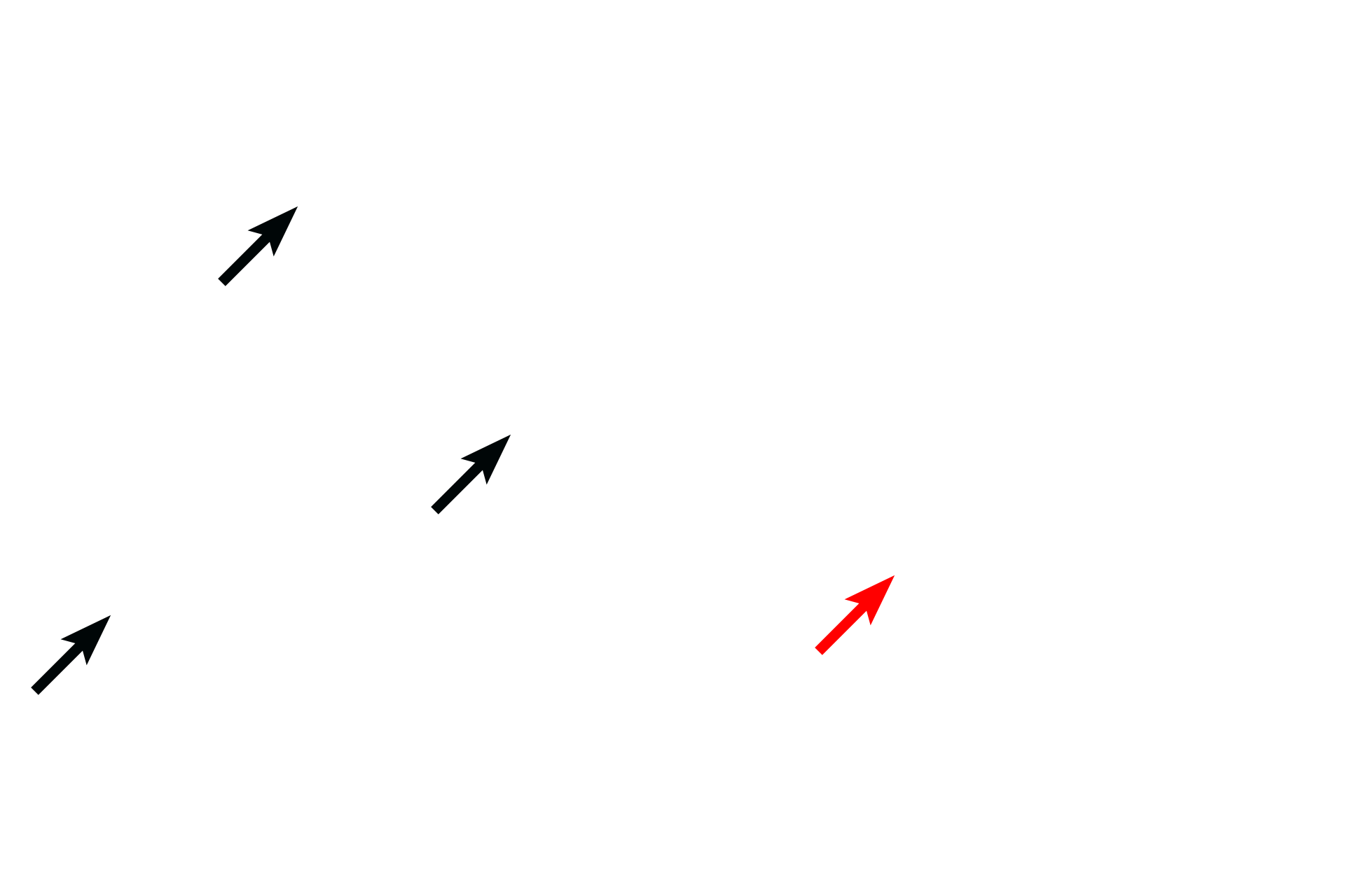Nuclei <p>The nucleus can be located in different parts of a cell depending on the type of cell and distribution of organelles.  Note the basal location of the nucleus in the wedge-shaped cells of the pancreas on the left, and central location of the nucleus in the neuron on the right.  1000x, 1000x</p>

