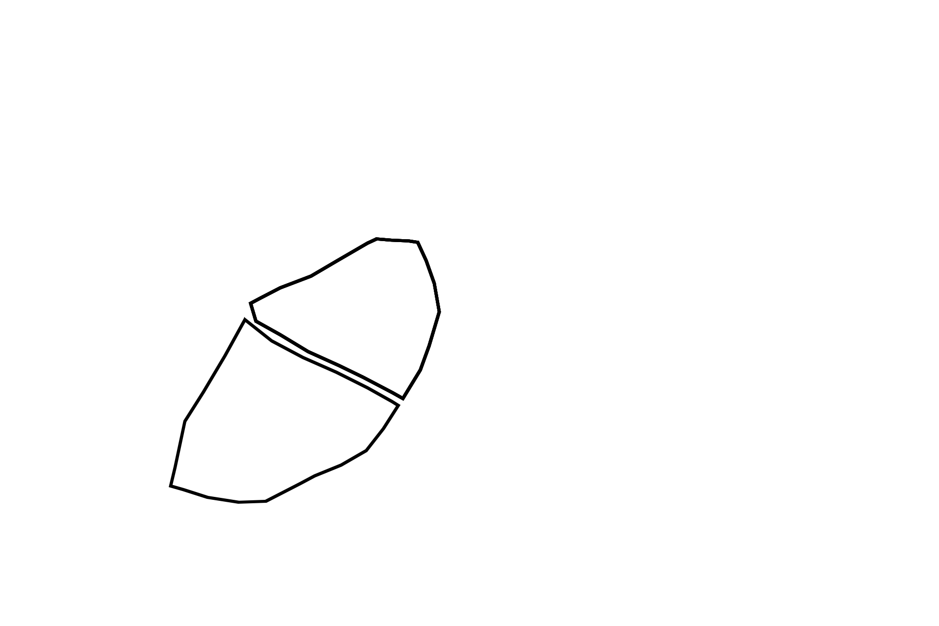 Cell outlines <p>The nucleus can be located in different parts of a cell depending on the type of cell and distribution of organelles.  Note the basal location of the nucleus in the wedge-shaped cells of the pancreas on the left, and central location of the nucleus in the neuron on the right.  1000x, 1000x</p>
