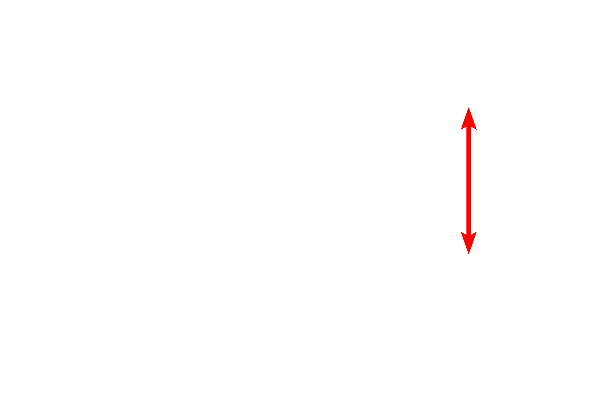 Heterochromatic nucleus <p>These images contrast the appearance of chromatin at the electron microscopic level.  Euchromatin appears electron lucent (left panel) because it is dispersed and, therefore, binds less metal.  In contrast, highly condensed chromatin binds metals at high density, which produces a darker image, as seen in the right panel.  Mucus-secreting cells (L)  5000x; Fibroblast (R)  7000x</p>
