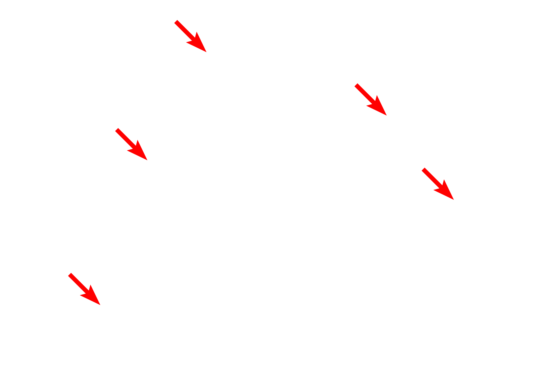 Euchromatin <p>These images contrast the appearance of chromatin at the electron microscopic level.  Euchromatin appears electron lucent (left panel) because it is dispersed and, therefore, binds less metal.  In contrast, highly condensed chromatin binds metals at high density, which produces a darker image, as seen in the right panel.  Mucus-secreting cells (L)  5000x; Fibroblast (R)  7000x</p>
