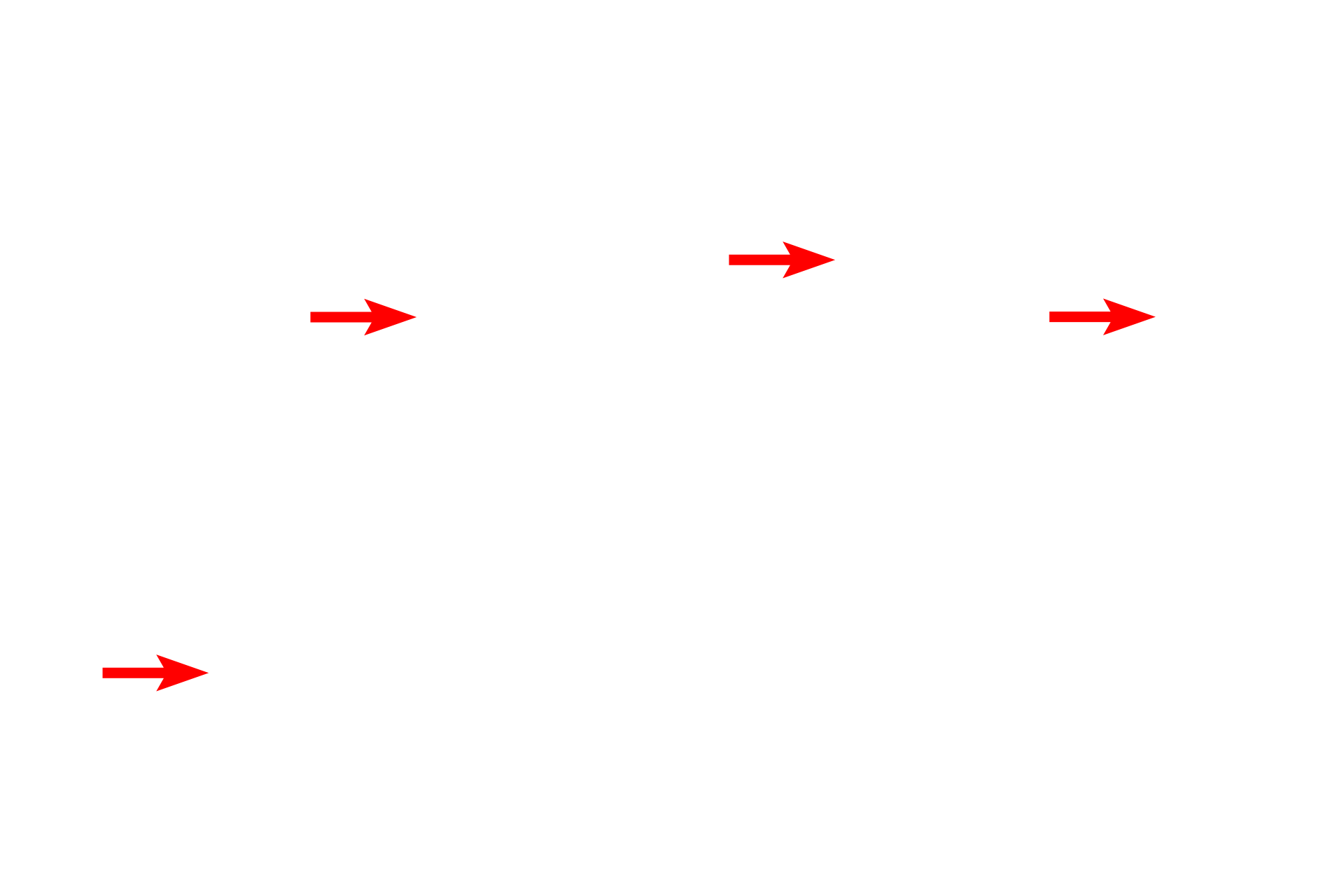 Heterochromatin <p>These images contrast the appearance of chromatin at the electron microscopic level.  Euchromatin appears electron lucent (left panel) because it is dispersed and, therefore, binds less metal.  In contrast, highly condensed chromatin binds metals at high density, which produces a darker image, as seen in the right panel.  Mucus-secreting cells (L)  5000x; Fibroblast (R)  7000x</p>
