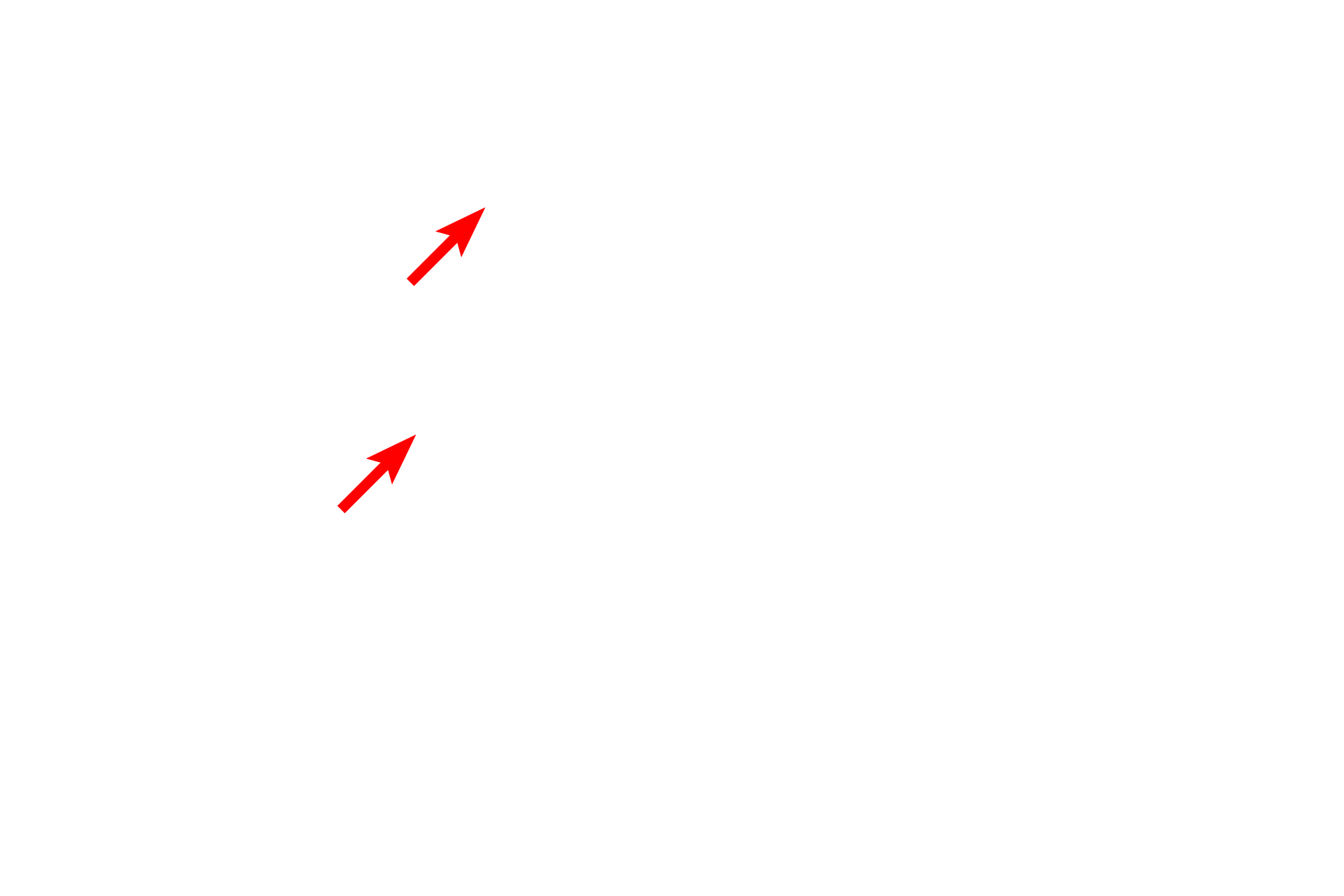 Nucleoli <p>These images contrast the appearance of chromatin at the electron microscopic level.  Euchromatin appears electron lucent (left panel) because it is dispersed and, therefore, binds less metal.  In contrast, highly condensed chromatin binds metals at high density, which produces a darker image, as seen in the right panel.  Mucus-secreting cells (L)  5000x; Fibroblast (R)  7000x</p>
