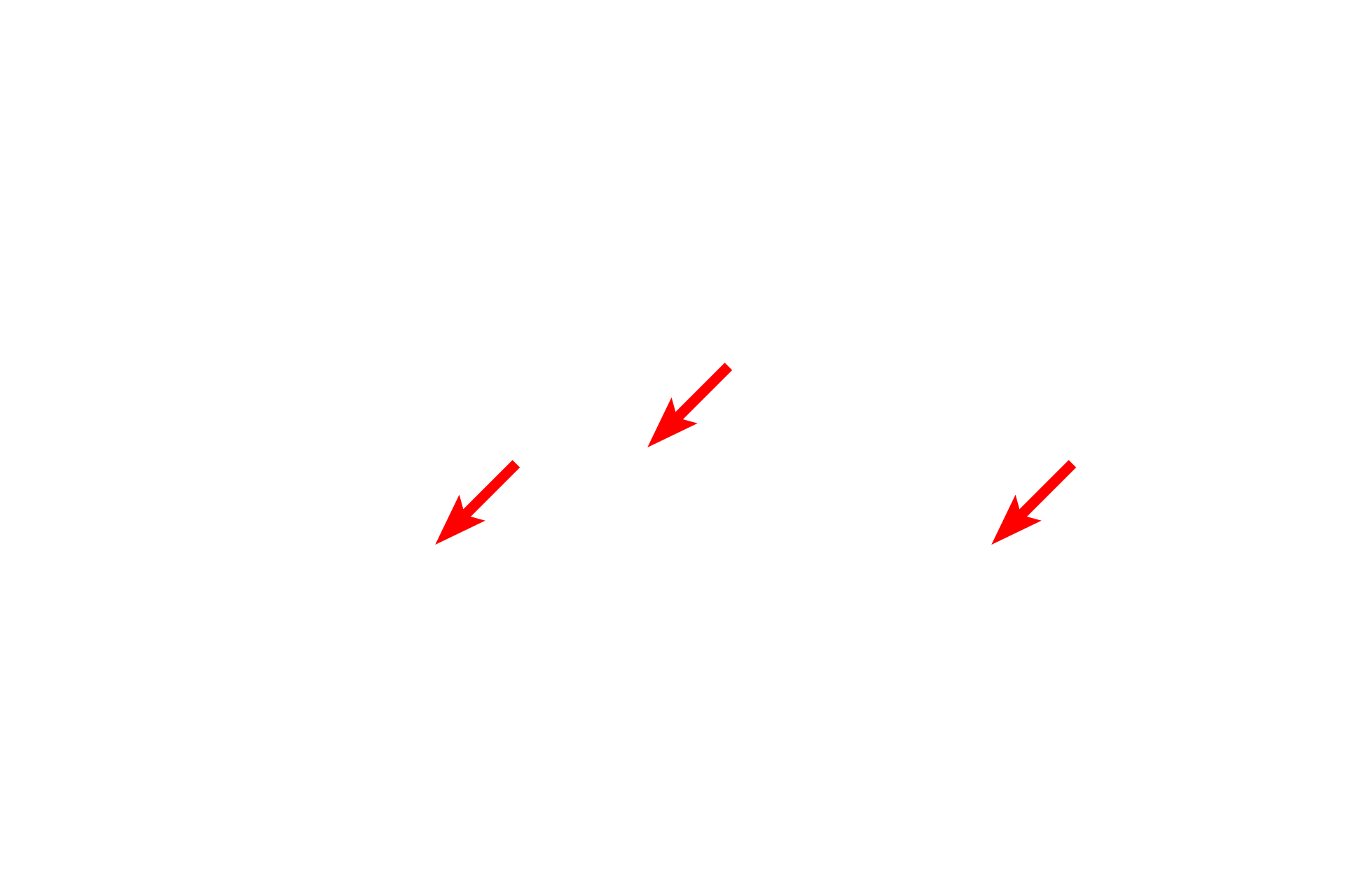  - Euchromatin <p>This mostly euchromatic nucleus possesses a prominent nucleolus.  A small amount of heterochromatin is present in a perinuclear distribution immediately beneath the nuclear envelope.  This is an example of a cell highly active in gene transcription.  15,000x</p>
