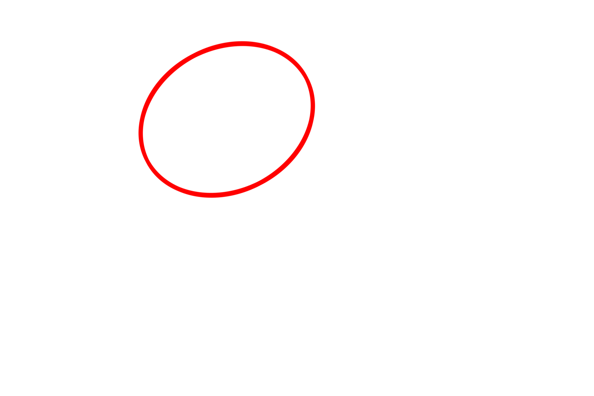  - Nucleolus <p>This mostly euchromatic nucleus possesses a prominent nucleolus.  A small amount of heterochromatin is present in a perinuclear distribution immediately beneath the nuclear envelope.  This is an example of a cell highly active in gene transcription.  15,000x</p>
