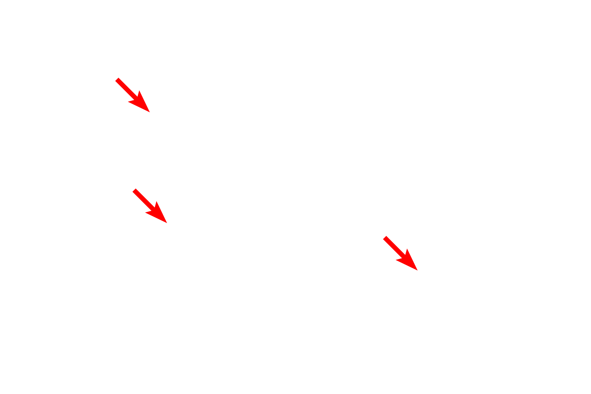  - Euchromatin <p>This nucleus is mostly euchromatic with a prominent nucleolus.  The paler staining areas contain euchromatin.  Small amounts of heterochromatin are dispersed throughout the nucleus and in a perinuclear location adjacent to the nuclear envelope.  17,000x</p>
