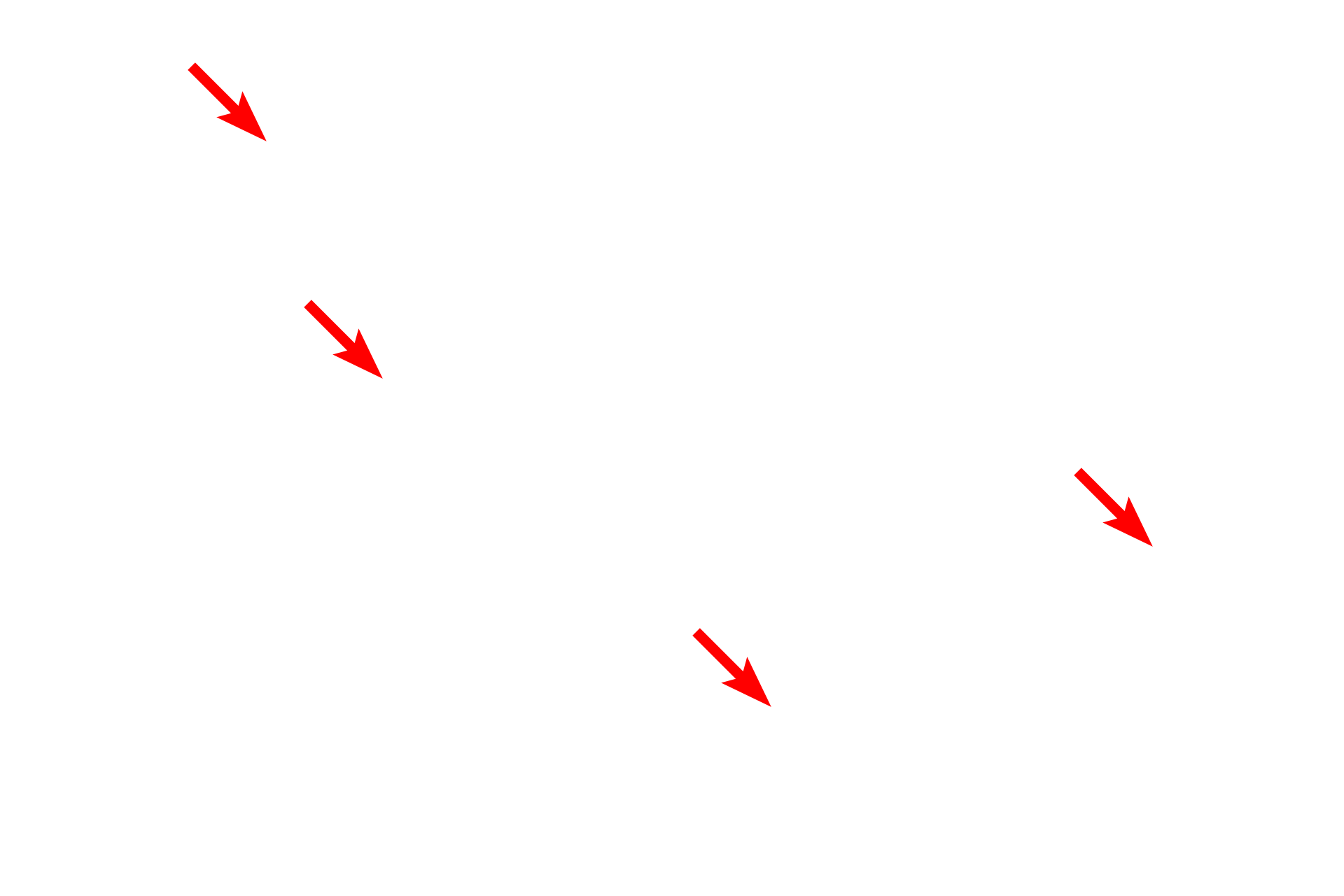  - Heterochromatin <p>This nucleus is mostly euchromatic with a prominent nucleolus.  The paler staining areas contain euchromatin.  Small amounts of heterochromatin are dispersed throughout the nucleus and in a perinuclear location adjacent to the nuclear envelope.  17,000x</p>
