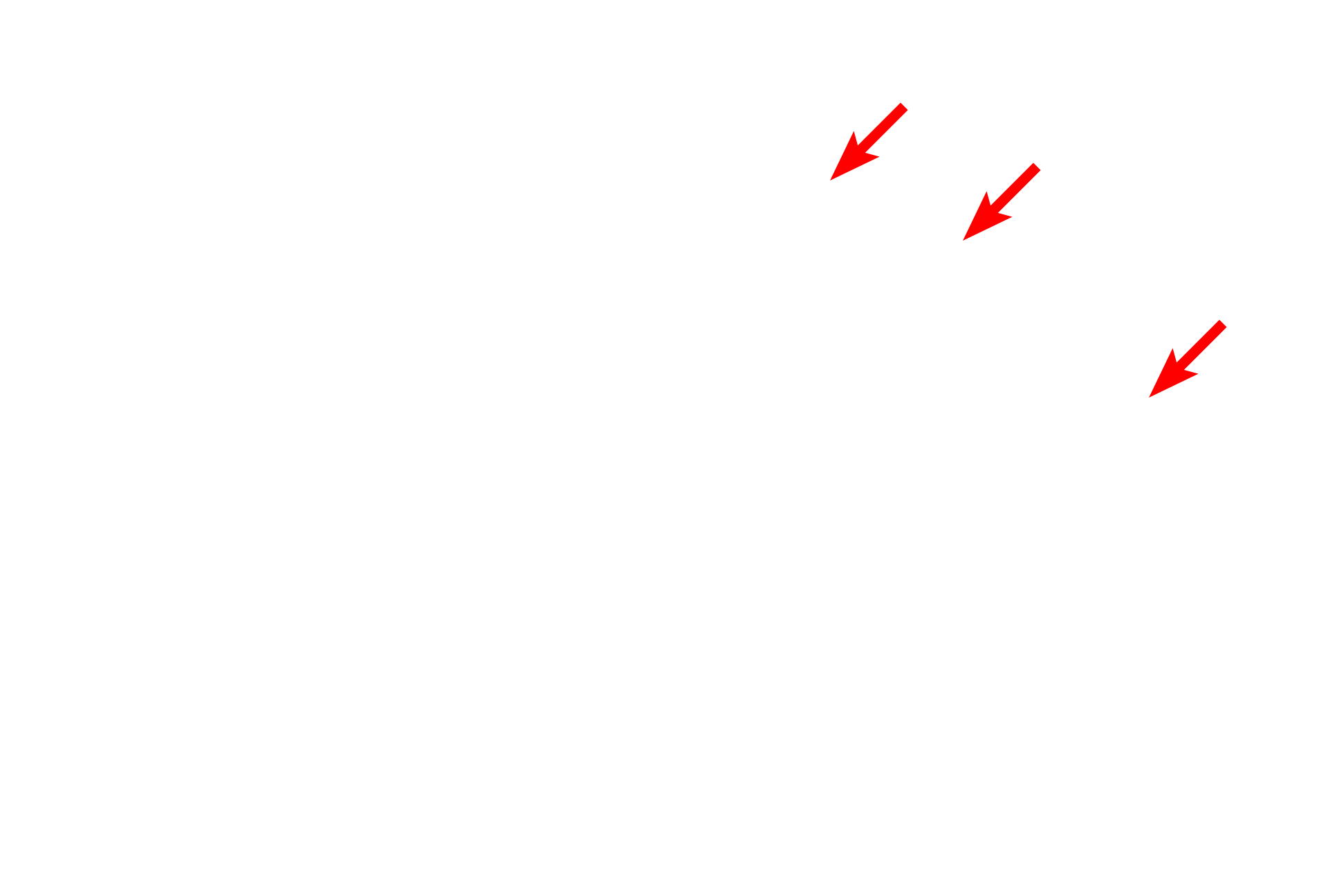  - Nuclear envelope <p>This nucleus is mostly euchromatic with a prominent nucleolus.  The paler staining areas contain euchromatin.  Small amounts of heterochromatin are dispersed throughout the nucleus and in a perinuclear location adjacent to the nuclear envelope.  17,000x</p>
