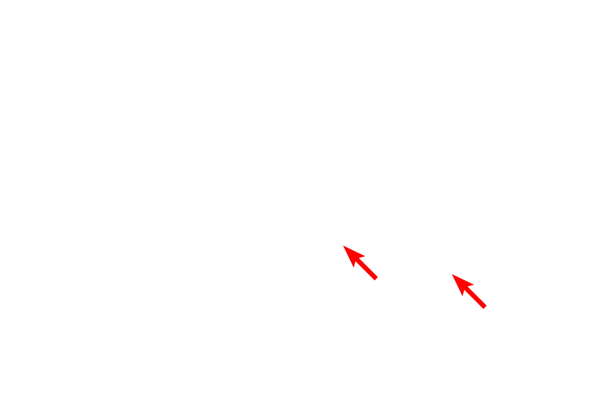  - Euchromatin <p>The nucleus of this cell demonstrates a large amount of heterochromatin which is mostly peripherally distributed.  In some cases the pattern of heterochromatin can be used to identify cells, such as in this plasma cell.  8000x</p>
