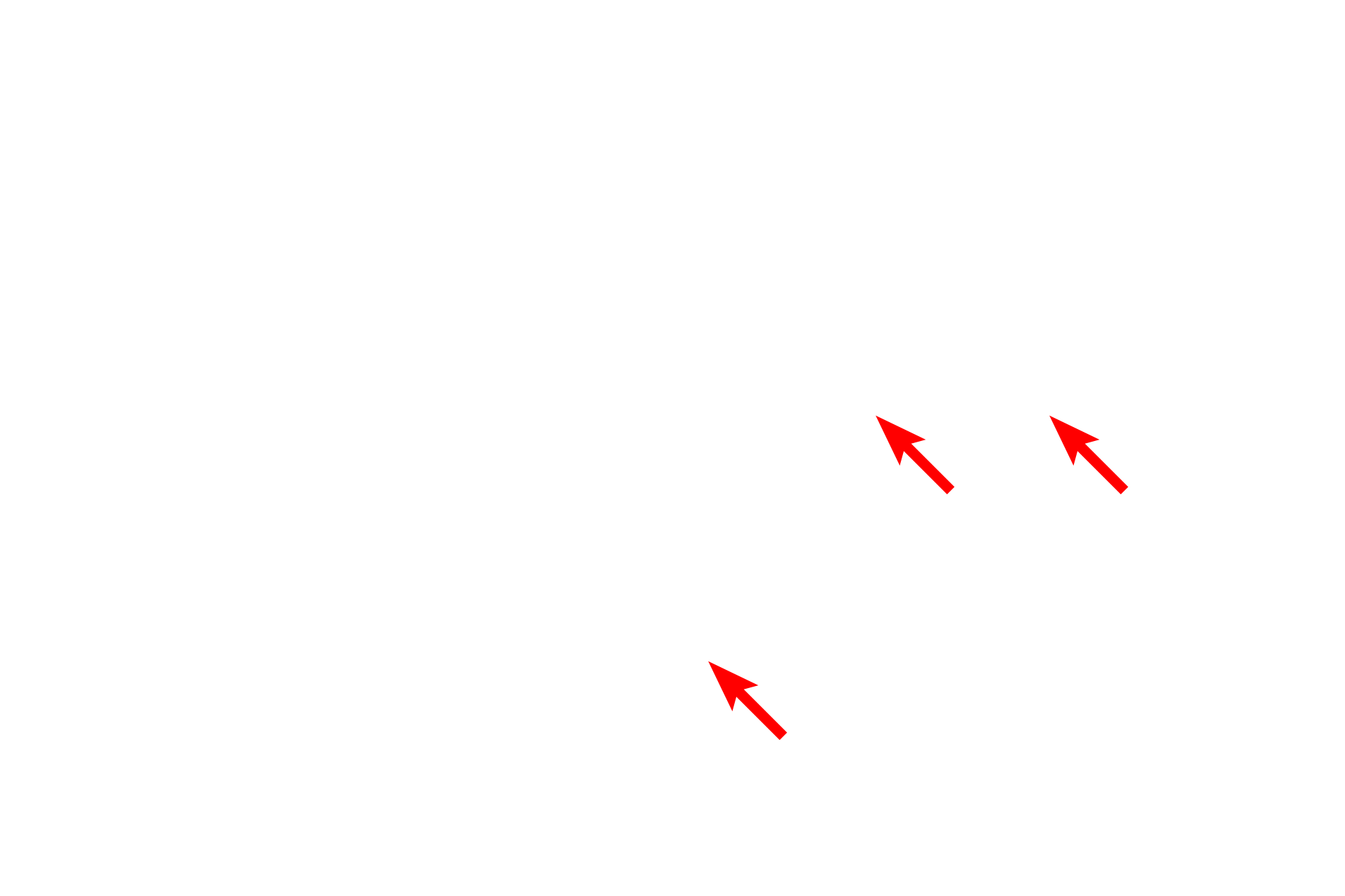  - Heterochromatin <p>The nucleus of this cell demonstrates a large amount of heterochromatin which is mostly peripherally distributed.  In some cases the pattern of heterochromatin can be used to identify cells, such as in this plasma cell.  8000x</p>

