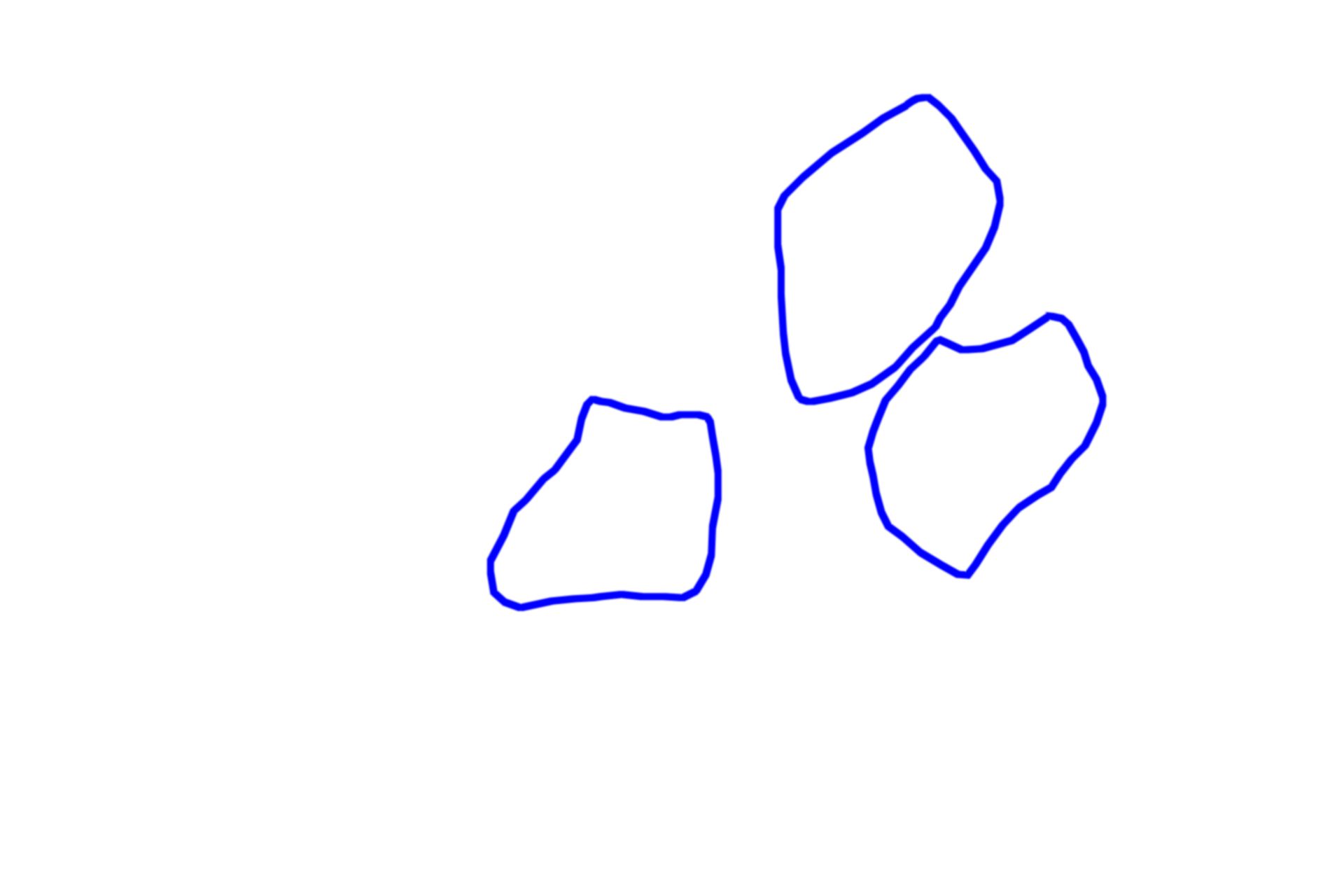  - Acinar cells <p>This image of the pancreas shows the apically located secretory granules in the pyramidal-shaped acinar cells that compose the pancreatic acinus.  Secretory granules that contain enzymes are specifically called zymogen granules.  Also prominent in this field is the basally located, blue-staining RER.  1000x</p>
