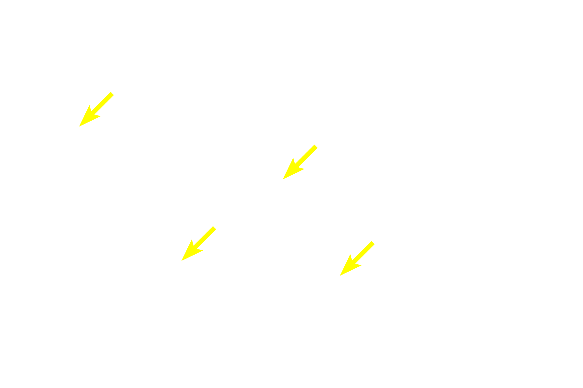Secretory granules <p>These exocrine secretory cells in a salivary gland contain basophilic secretory granules.  The staining property of these granules indicates that their contents are negatively charged.  Note the eosinophilic cytoplasm of the cuboidal cells which compose the secretory ducts of the gland.  Submandibular gland  1000x</p>
