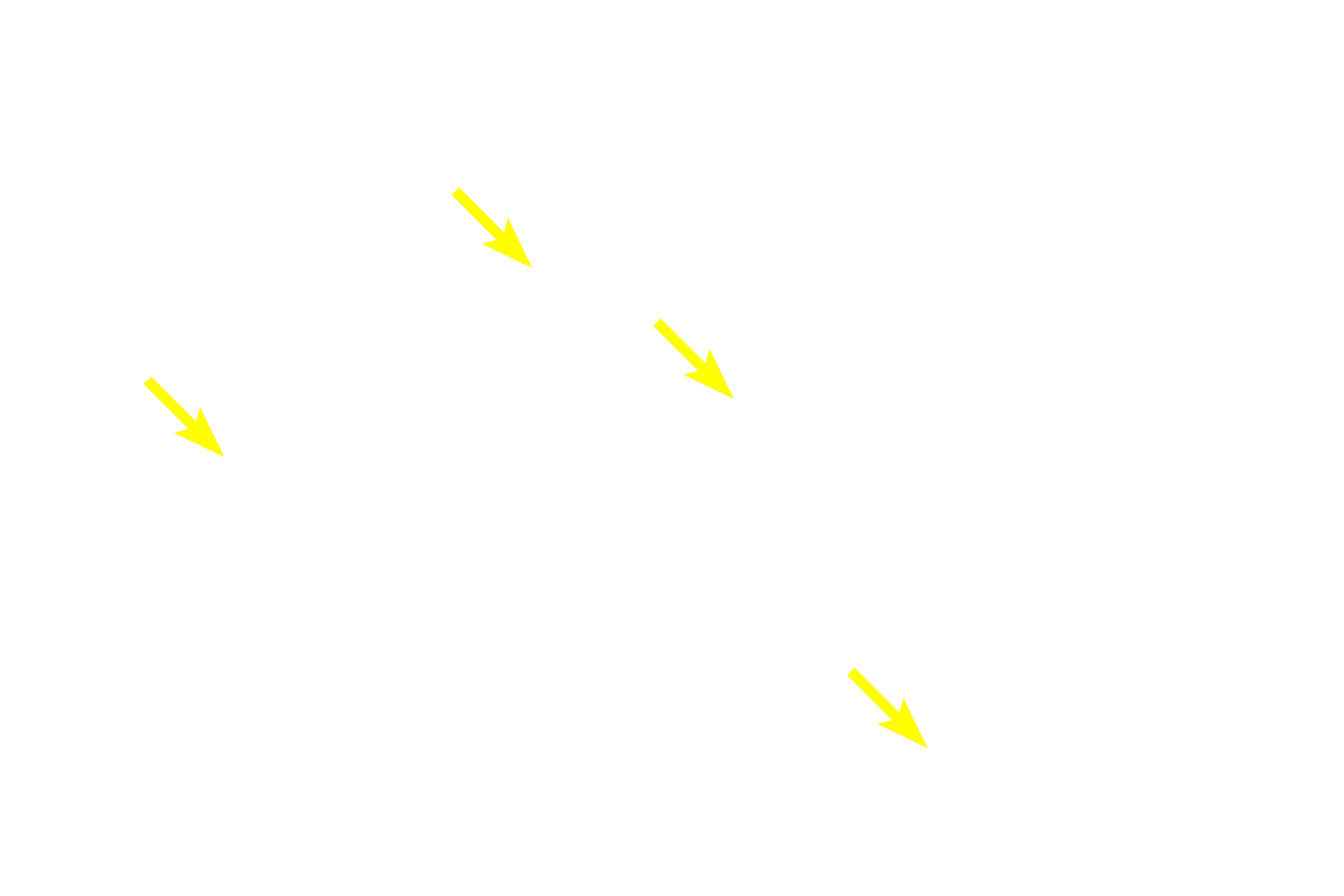 Nuclei <p>These exocrine secretory cells in a salivary gland contain basophilic secretory granules.  The staining property of these granules indicates that their contents are negatively charged.  Note the eosinophilic cytoplasm of the cuboidal cells which compose the secretory ducts of the gland.  Submandibular gland  1000x</p>
