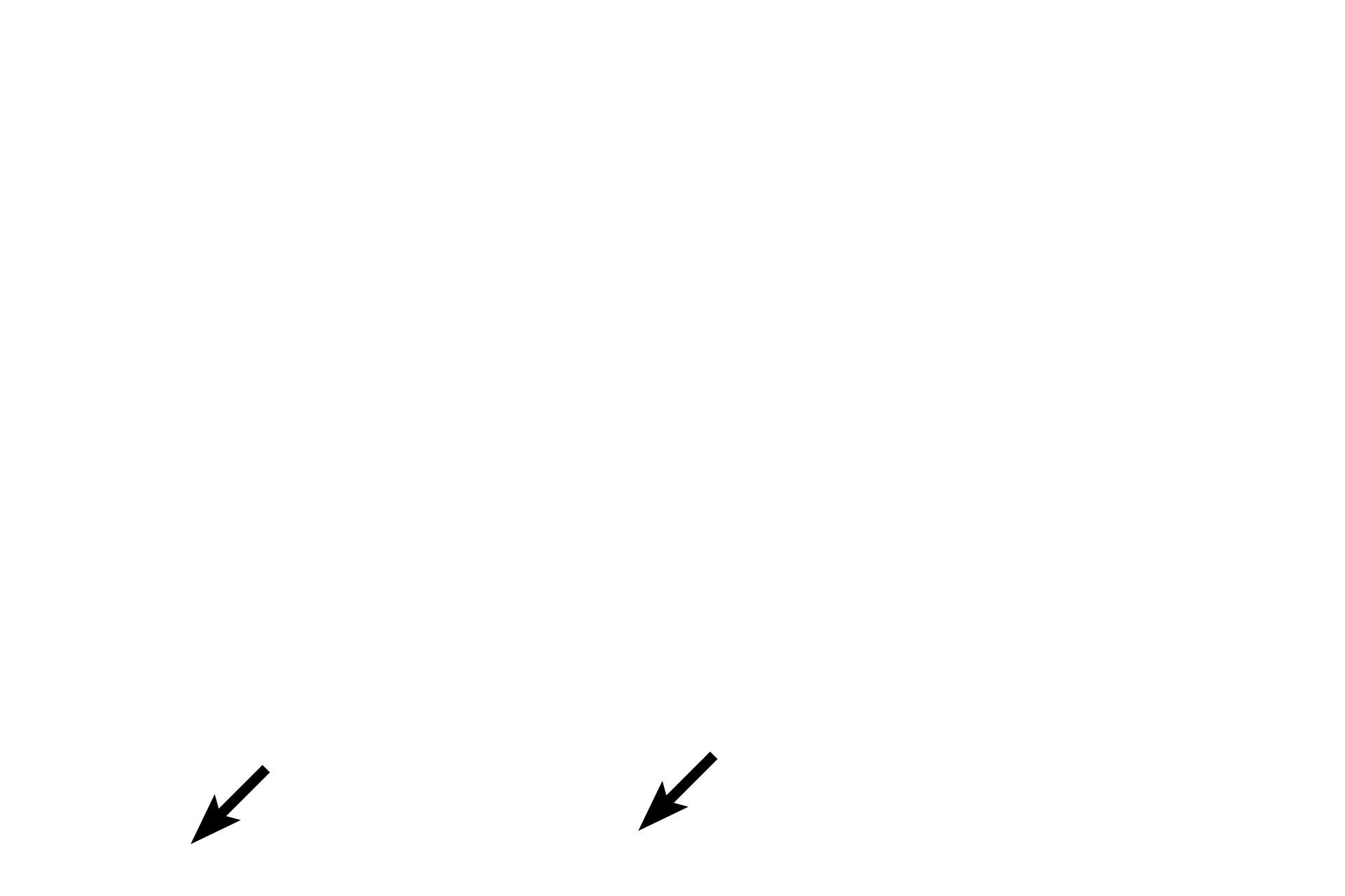  - Duct lumens <p>These exocrine secretory cells in a salivary gland contain basophilic secretory granules.  The staining property of these granules indicates that their contents are negatively charged.  Note the eosinophilic cytoplasm of the cuboidal cells which compose the secretory ducts of the gland.  Submandibular gland  1000x</p>

