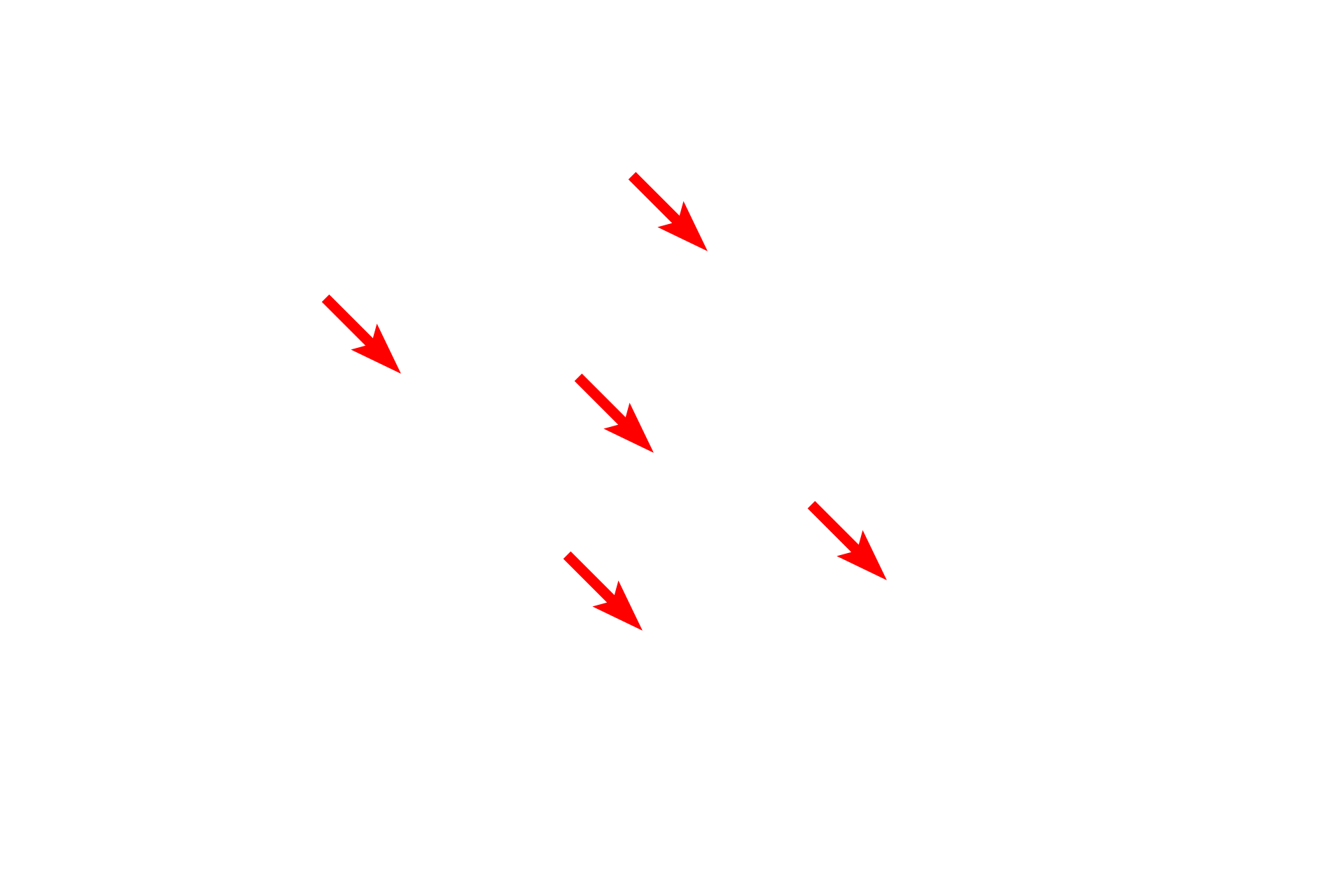  - Secretory granules <p>This electron micrograph of a pancreatic acinus shows secretory granules in the apex of each cell and the RER and nucleus at the base.  These secretory granules contain digestive enzymes, and thus, are referred to as zymogen granules.  The contents of these granules are released by exocytosis into the lumen at the center of the acinus.  4000x</p>
