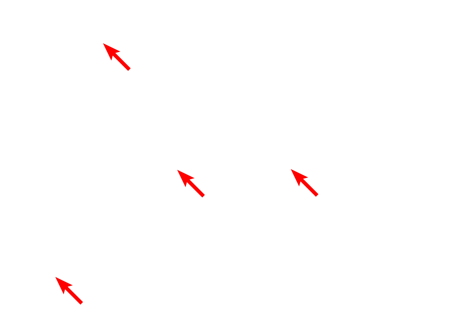  - Secretory granules <p>This electron micrograph illustrates secretory granules in the endocrine cells composing the islets of Langerhans of the pancreas.  These electron-dense granules are distributed throughout the cytoplasm, indicating the lack of polarity, a characteristic of endocrine cells.  Endocrine pancreas (islets of Langerhans) 12,000x</p>
