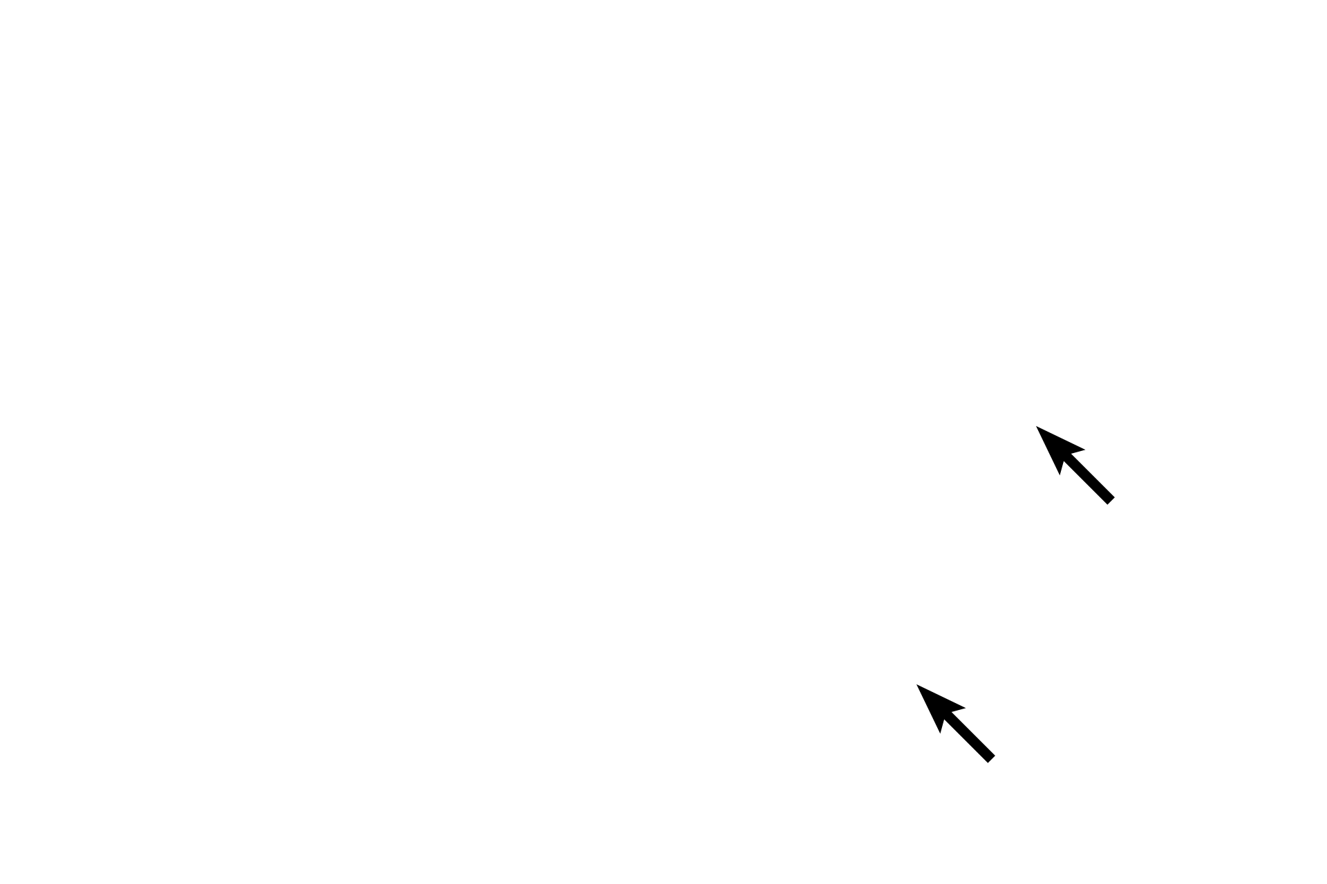Capillaries <p>Mast cells are connective tissue cells that can be readily identified by their coarse secretory granules.  These granules have a reddish color with H & E staining and a purplish-blue color with toluidine blue.  Mast cell granules contain histamine and heparin, which are released following exposure to allergens.  Numerous capillaries are also present.  Testis  1000x</p>
