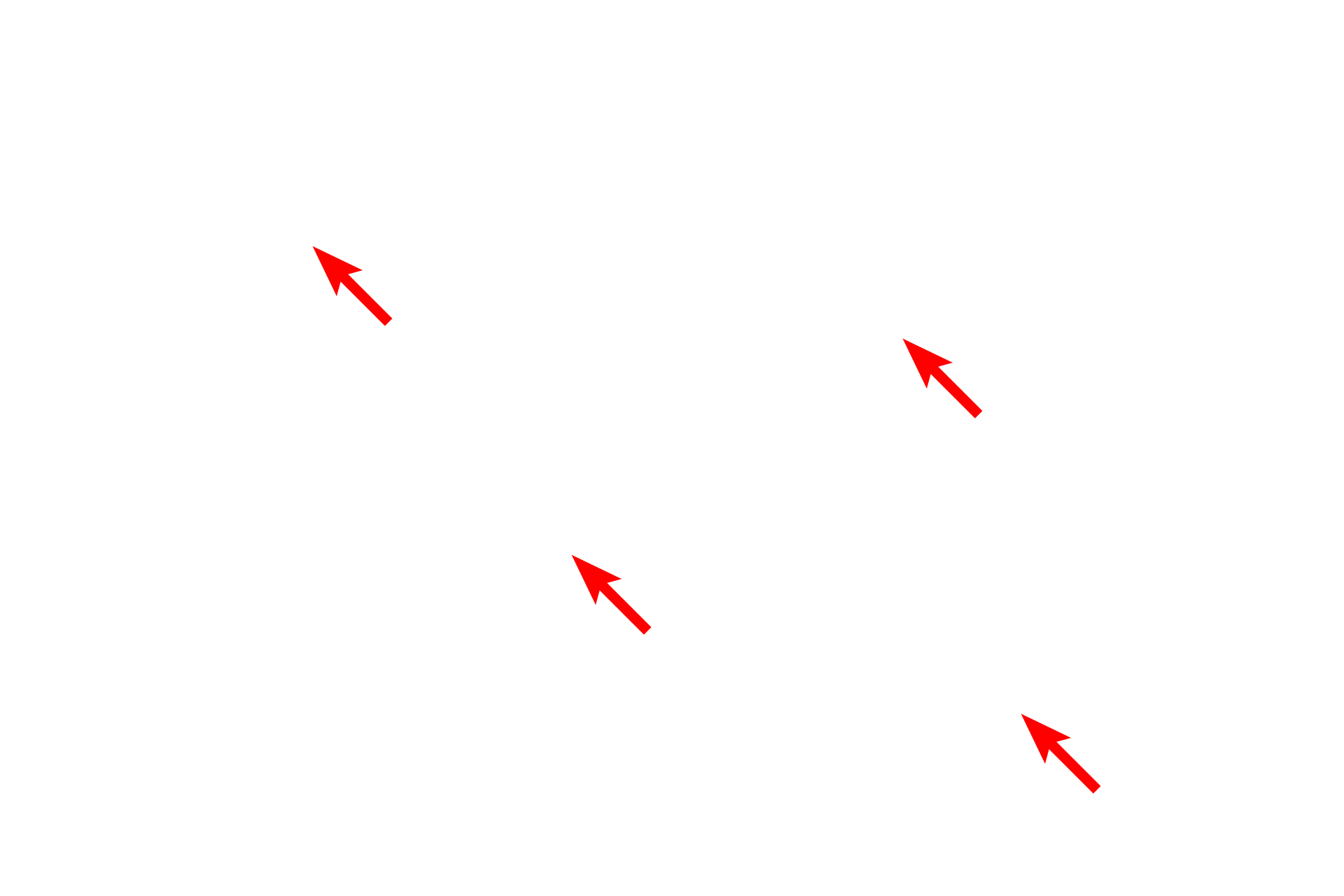 Secretory granules <p>A mast cell is shown in loose connective tissue.  The centrally located, round nucleus is surrounded by numerous secretory granules, containing histamine, heparin and other substances.  Mast cells do not display polarity of their granules because the granules are located throughout the cytoplasm.  Bundles of collagen fibrils are also visible.  10,000x</p>
