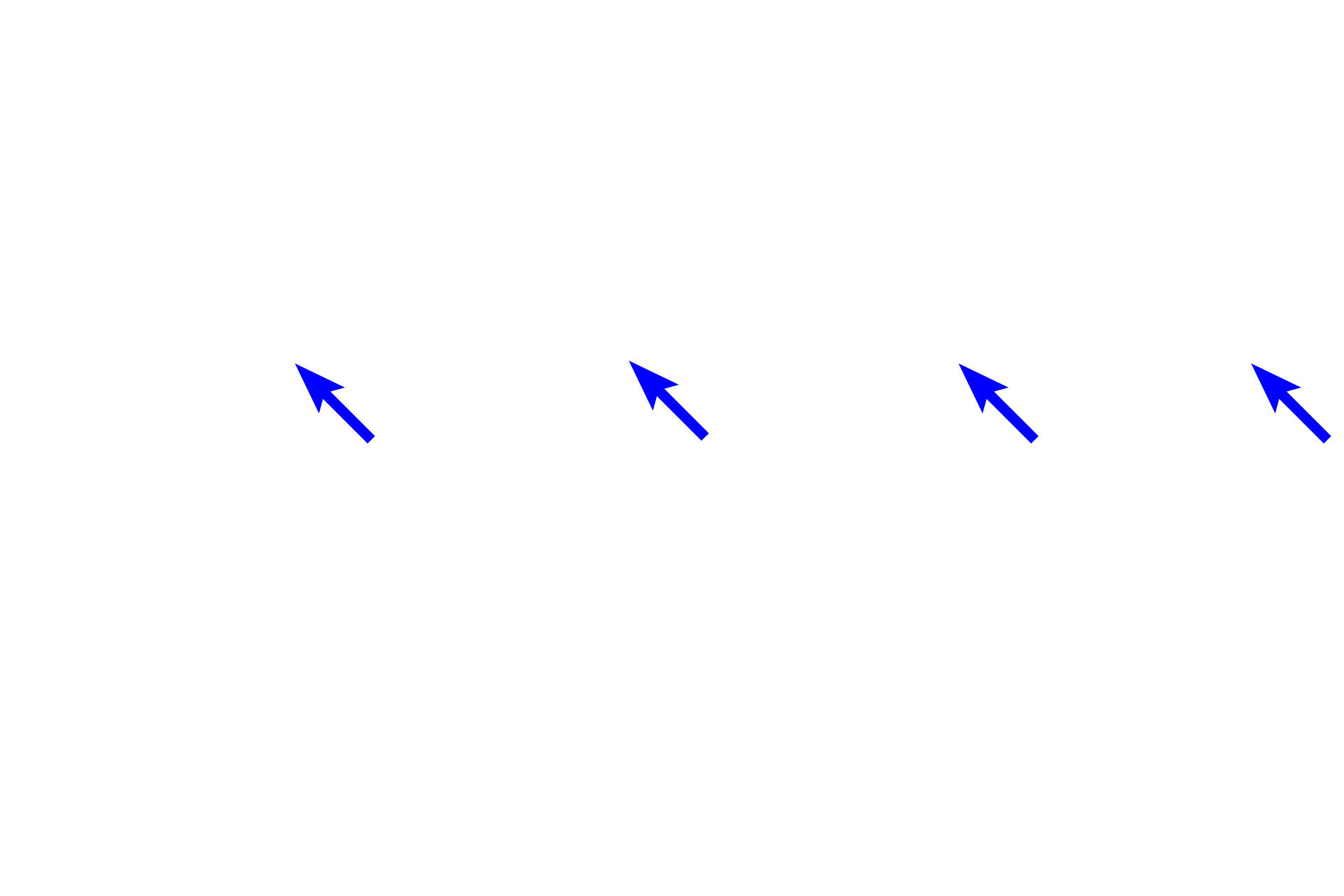 Simple epithelia > <p>Simple epithelia consist of a single layer of cells that all lie on the basement membrane (arrows).  The cells may be squamous shaped (like a fried egg), cuboidal, columnar, or a combination of cell shapes.  Only simple epithelia have surface modifications such as microvilli and cilia.</p>
