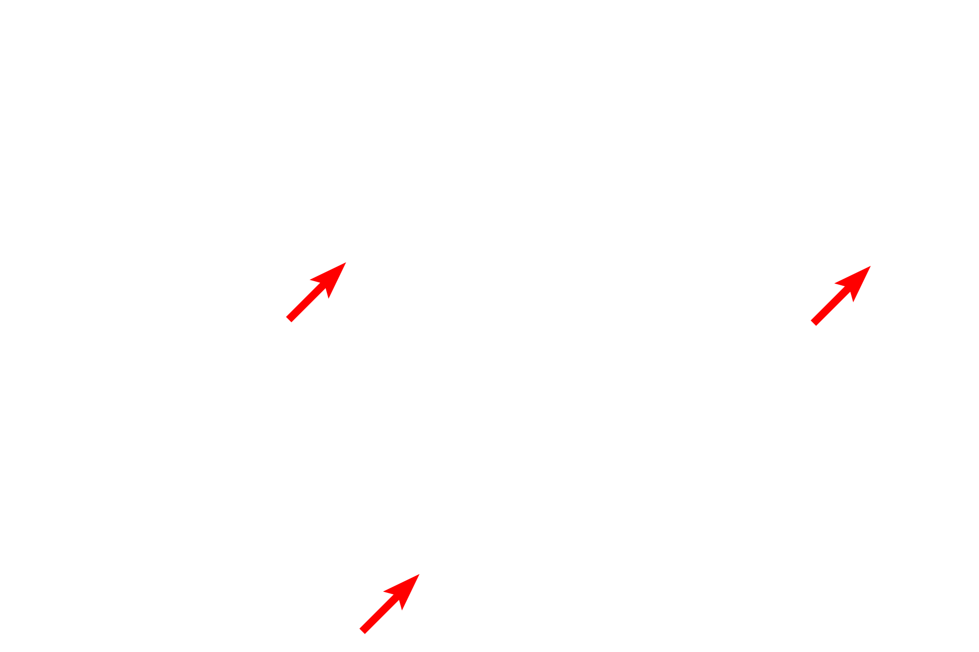 Basement membrane > <p>All epithelia rest on a basement membrane, which consists of a basal lamina, produced by the epithelial cells, and a reticular lamina, produced by fibroblasts in the underlying connective tissue.  Because the basal lamina and reticular lamina cannot be resolved with the light microscope, the term basement membrane is used in light microscopy to refer to both of these structures, collectively.</p>
