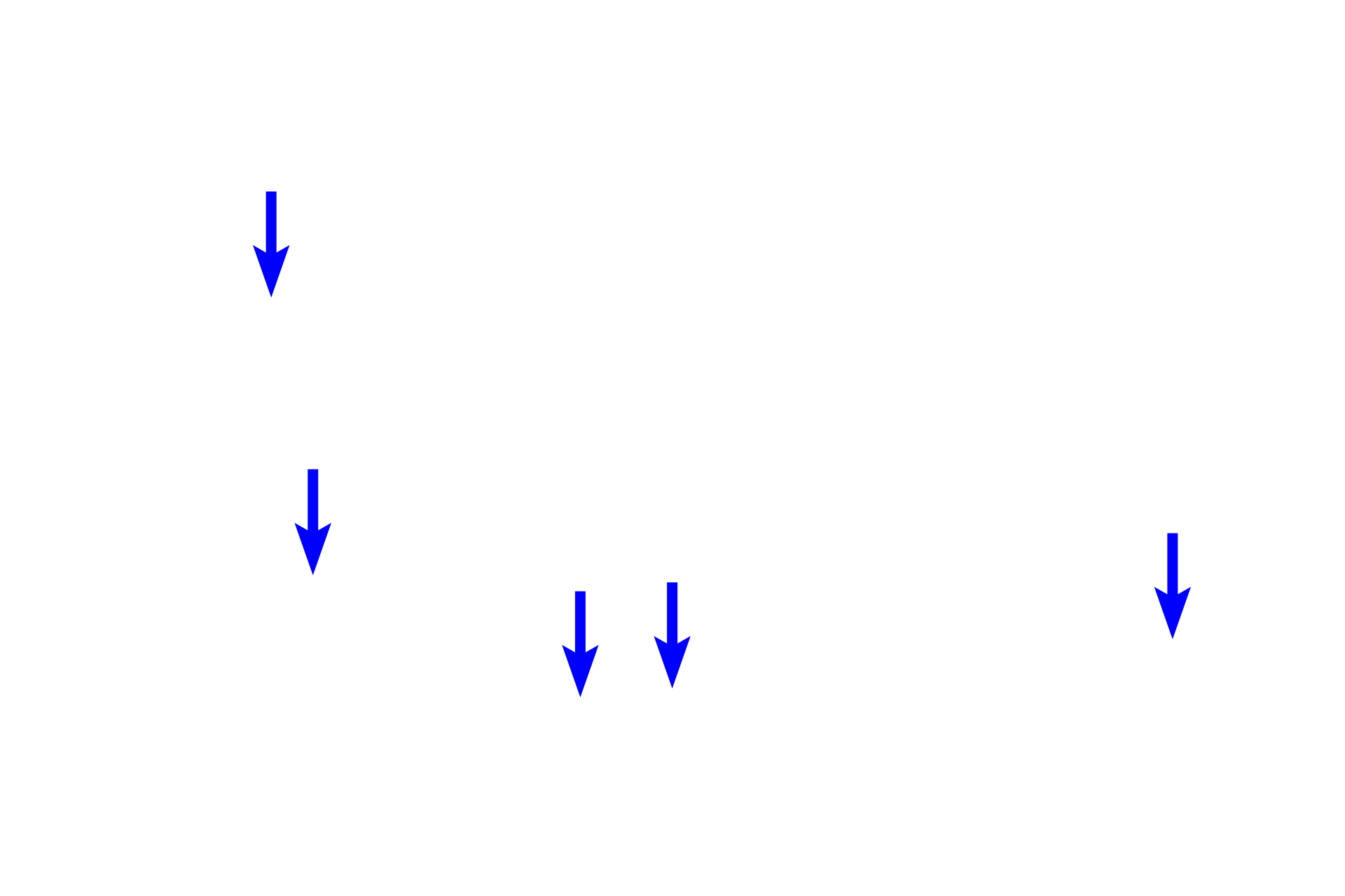 Nuclei <p>Cardiac muscle fibers comprise the myocardium of the heart and extends into the attachments of the large veins. Cardiac muscle tissue, seen here in cross section, shows numerous fibers with centrally located nuclei and surrounding myofibrils. The presence of these myofibrils and the size of the muscle fiber distinguishes this muscle type from smooth muscle fibers which are smaller and lack myofibrils. 200x</p>
