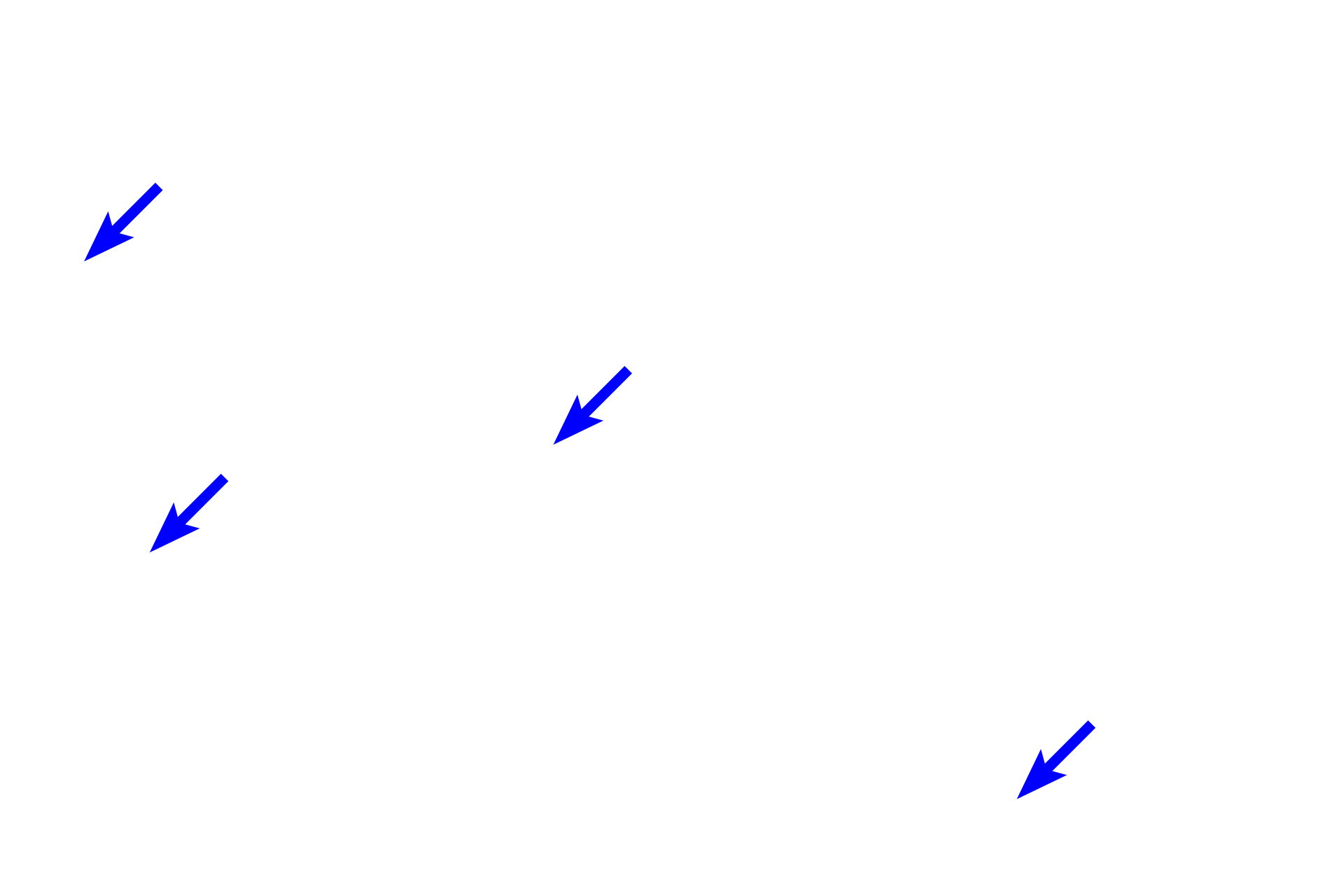Connective tissue <p>Cardiac muscle fibers comprise the myocardium of the heart and extends into the attachments of the large veins. Cardiac muscle tissue, seen here in cross section, shows numerous fibers with centrally located nuclei and surrounding myofibrils. The presence of these myofibrils and the size of the muscle fiber distinguishes this muscle type from smooth muscle fibers which are smaller and lack myofibrils. 200x</p>
