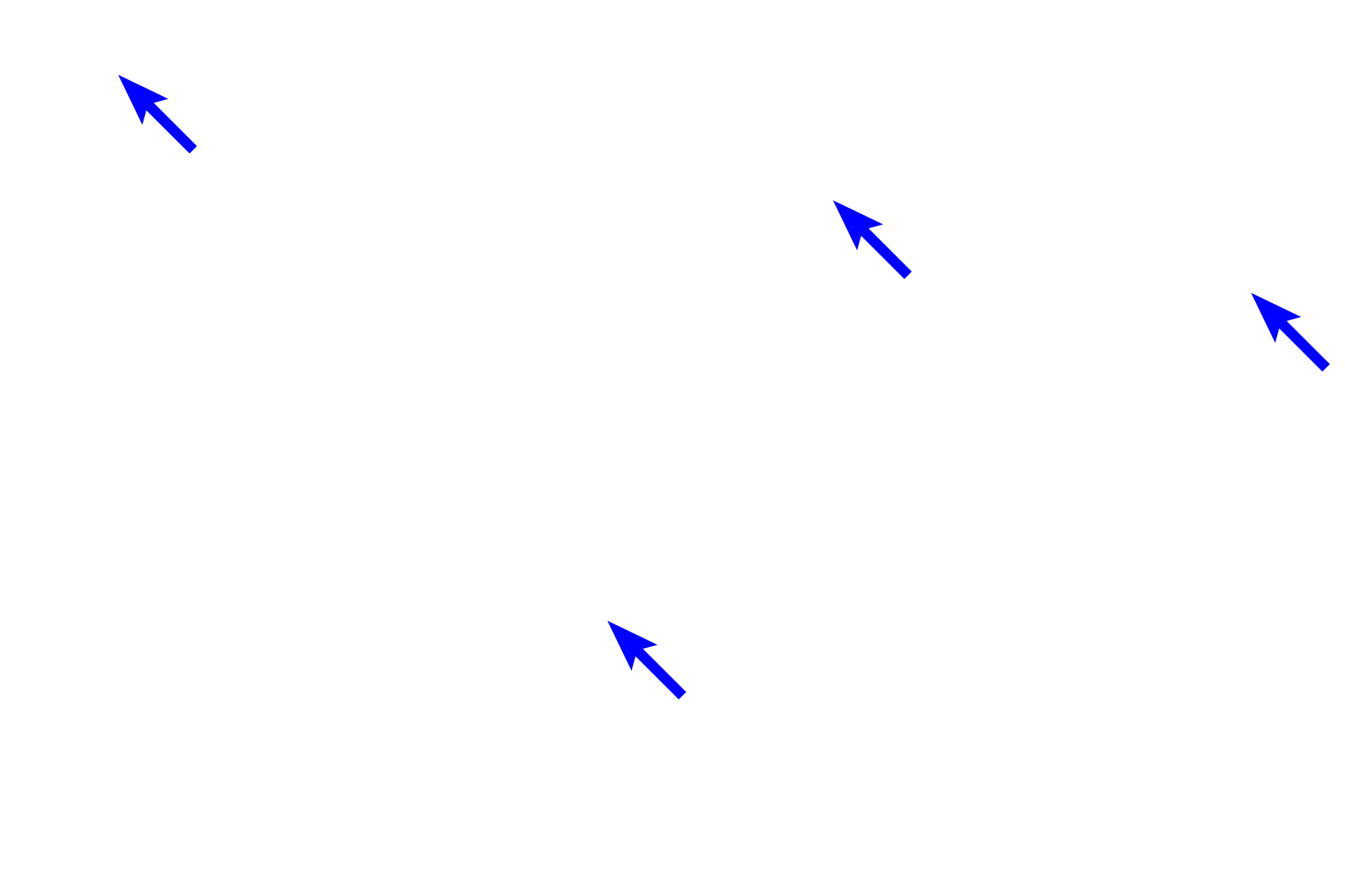 Blood vessels <p>Cardiac muscle fibers comprise the myocardium of the heart and extends into the attachments of the large veins. Cardiac muscle tissue, seen here in cross section, shows numerous fibers with centrally located nuclei and surrounding myofibrils. The presence of these myofibrils and the size of the muscle fiber distinguishes this muscle type from smooth muscle fibers which are smaller and lack myofibrils. 200x</p>
