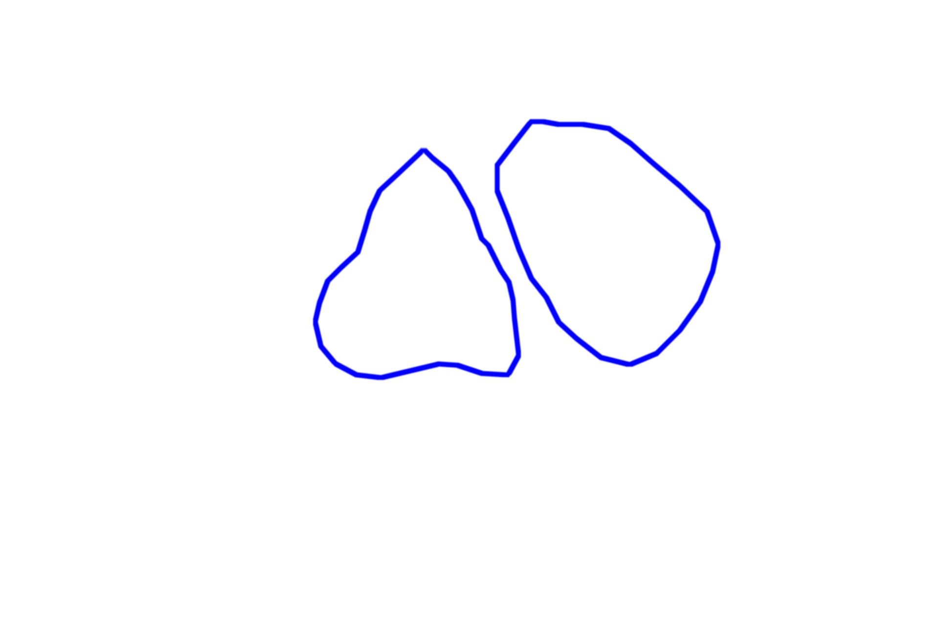 Muscle fibers > <p>Cardiac muscle fibers possess many of the same components as skeletal muscle, although cardiac fibers are not as heavily striated. Myofibrils in cardiac muscle fibers contain thin and thick myofilaments that are organized and function as they do in skeletal muscle fibers. Cardiac muscle fibers differ from skeletal by having centrally-located nuclei and branching fibers.</p>
