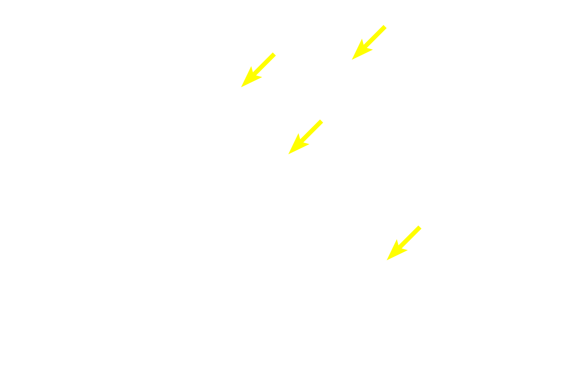 Nuclei <p>This longitudinal section of cardiac muscle fibers demonstrates two of their distinctive features, centrally located nuclei and intercalated discs. Intercalated discs are complex cell junctions between the ends of adjacent cardiac muscle fibers. Components of intercalated disc cannot be resolved with the light microscope. 400x</p>
