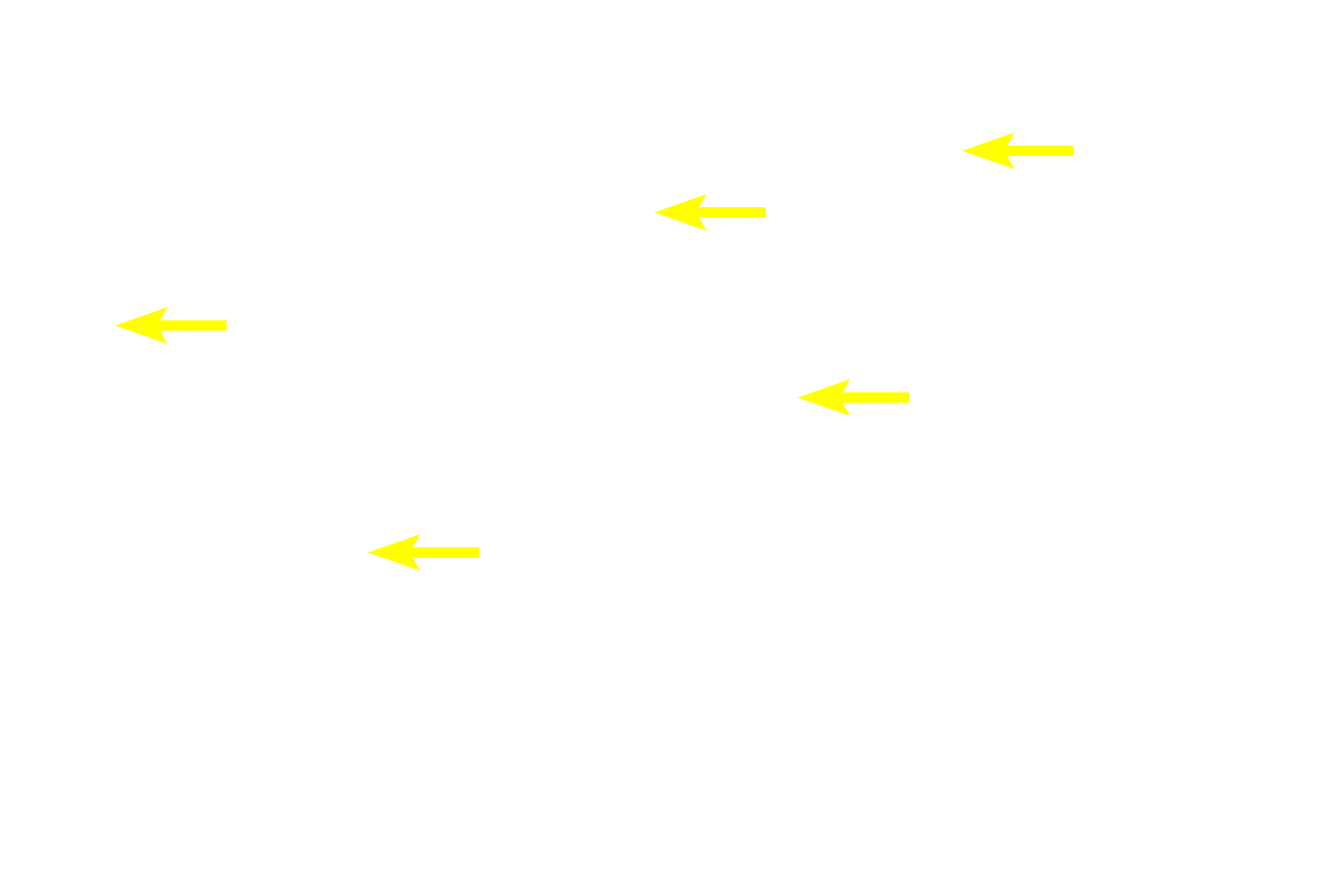 Intercalated discs <p>This longitudinal section of cardiac muscle fibers demonstrates two of their distinctive features, centrally located nuclei and intercalated discs. Intercalated discs are complex cell junctions between the ends of adjacent cardiac muscle fibers. Components of intercalated disc cannot be resolved with the light microscope. 400x</p>

