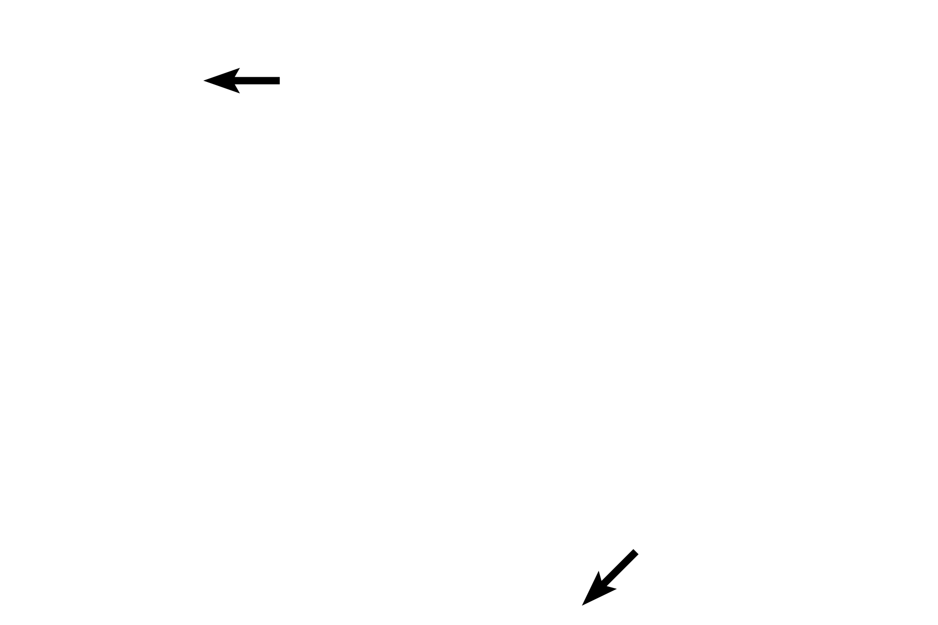 Nuclei <p>Intercalated discs and myobrils are seen in greater detail in this high magnification image of longitudinally-sectioned cardiac muscle fibers. Intercalated discs are composed of the interdigitating plasma membranes of adjacent fibers along with adherent and communicating cell junctions. 1000x</p>

