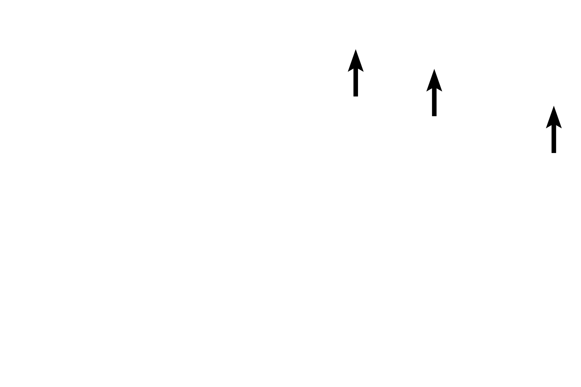 Capillary <p>Intercalated discs and myobrils are seen in greater detail in this high magnification image of longitudinally-sectioned cardiac muscle fibers. Intercalated discs are composed of the interdigitating plasma membranes of adjacent fibers along with adherent and communicating cell junctions. 1000x</p>
