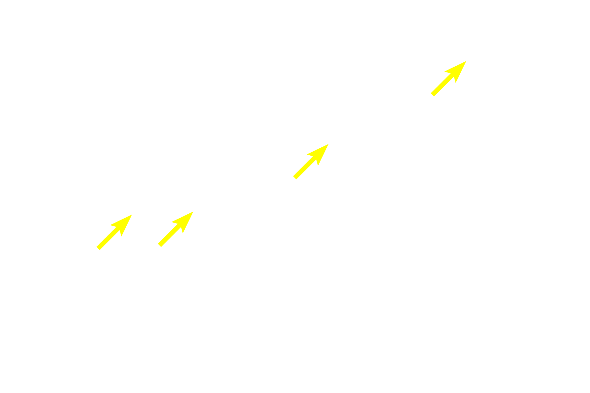  - Myofibrils <p>A cross section of two skeletal muscle fibers demonstrates the numerous myofibrils filling each fiber. Nuclei are displaced to the periphery of each fiber, just beneath the sacrolemma. 1500x</p>
