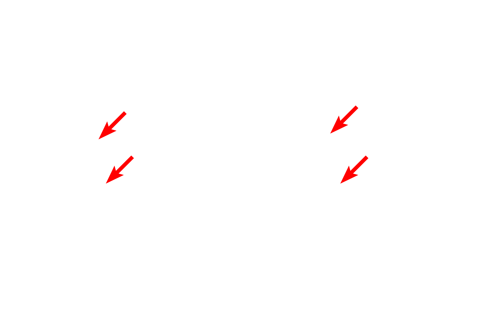  - Z lines <p>The sarcomere is the contractile unit of striated muscle and extends from one Z line to an adjacent Z line. During contraction, the width of the sarcomere narrows. The width of the A band remains constant, but both the I and H bands narrow as the areas of overlap of thin and thick myofilaments increase.</p>
